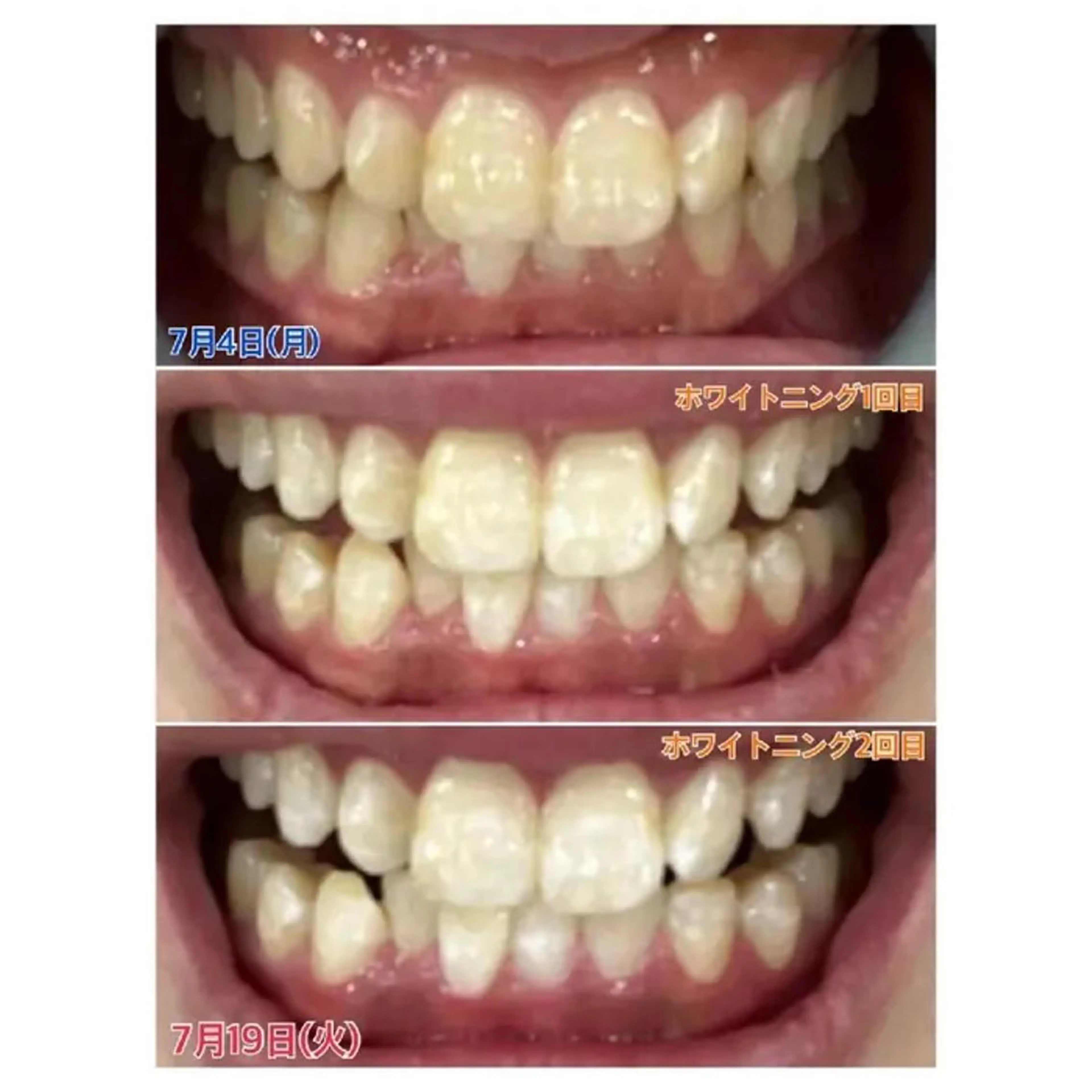 M渋谷店所属・Ｍ渋谷 ホワイトニングのその他イメージ