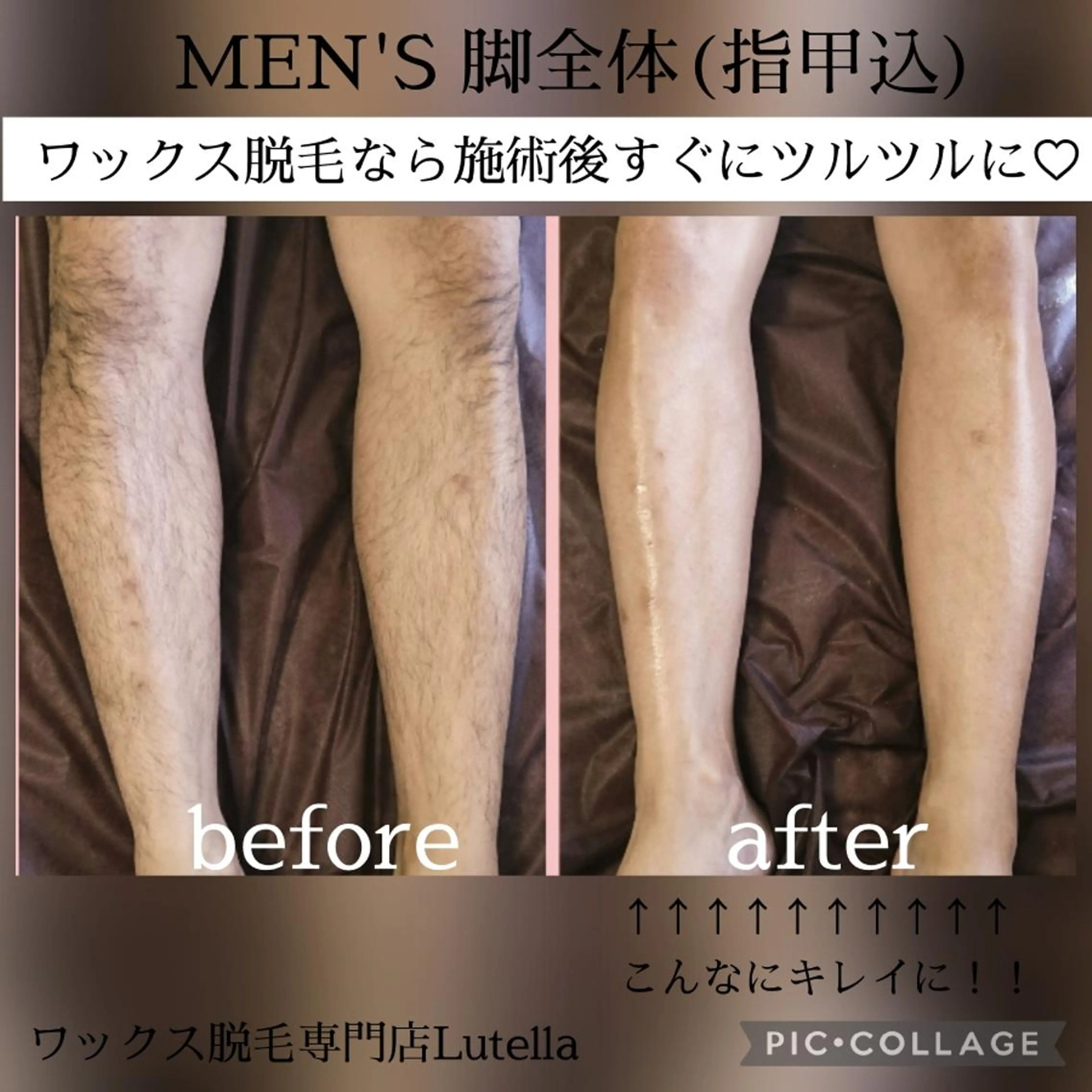 【メンズ】脚全体(甲指込)9,350円の写真