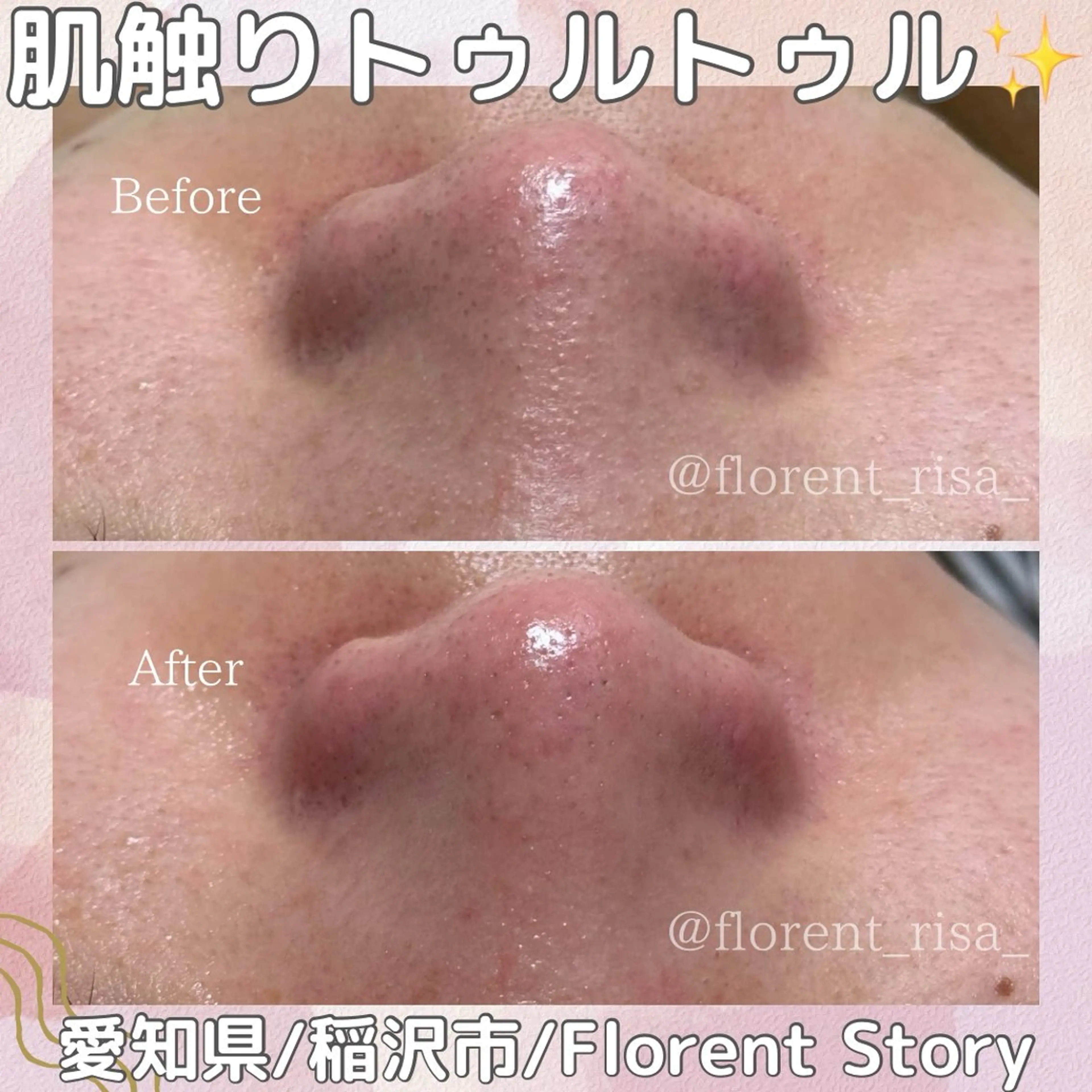 エステ 田中 里沙のエステ・リラクイメージ