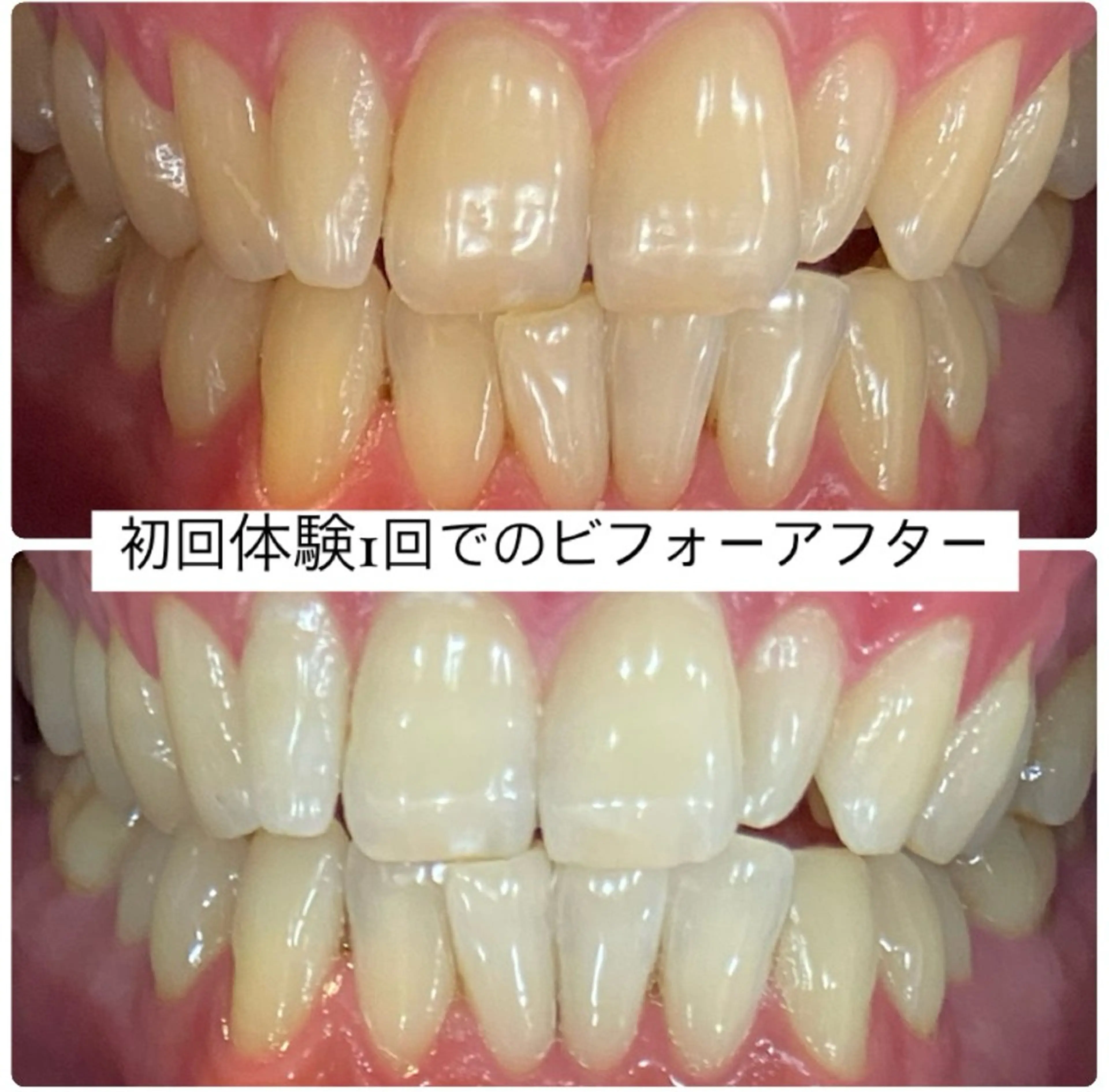 PLATINUM Beauty 横浜店所属・ホワイトニングルーム 横浜店のその他イメージ