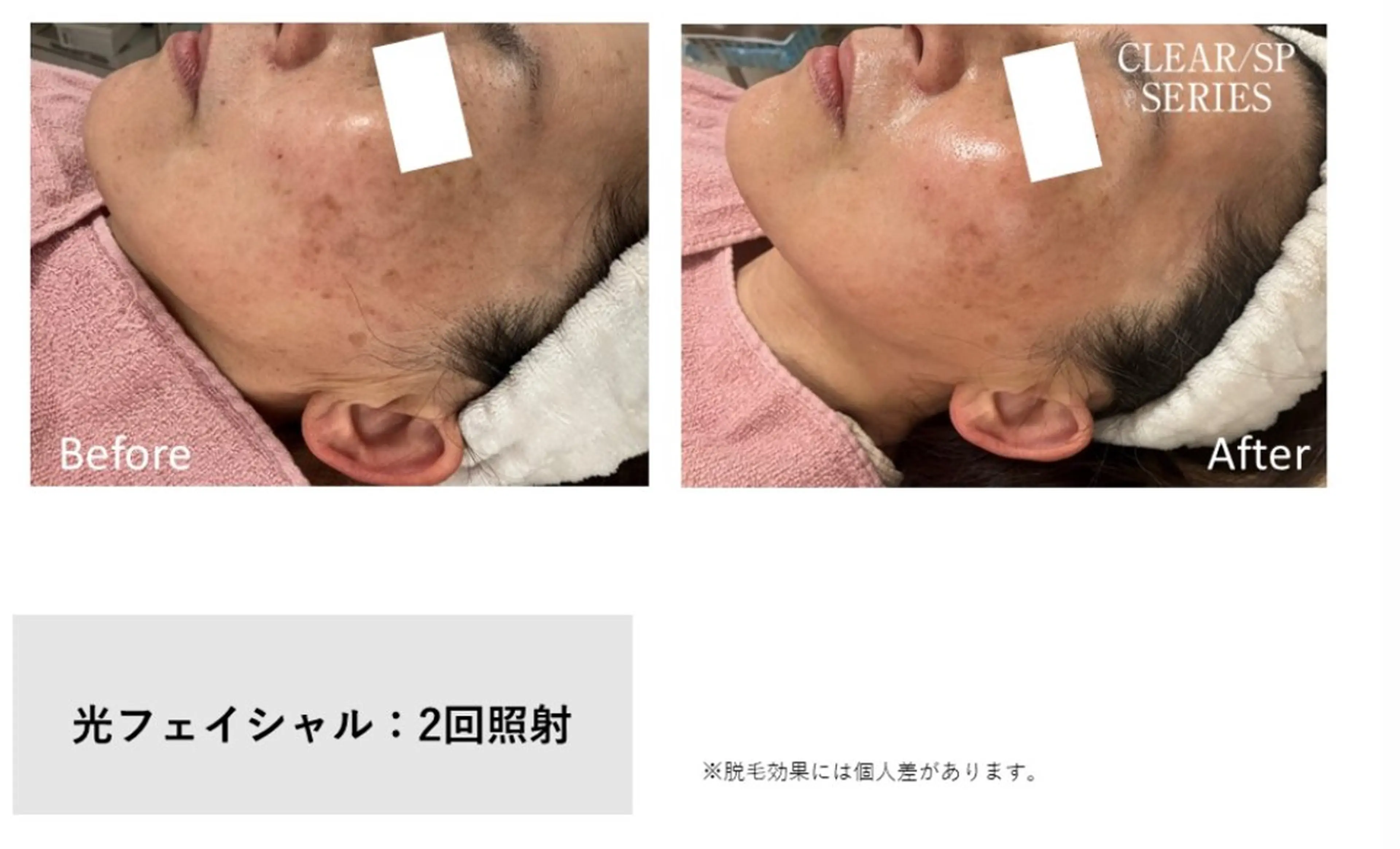 【痩身・脱毛】private salon Eclat所属・伊藤 心のエステ・リラクイメージ