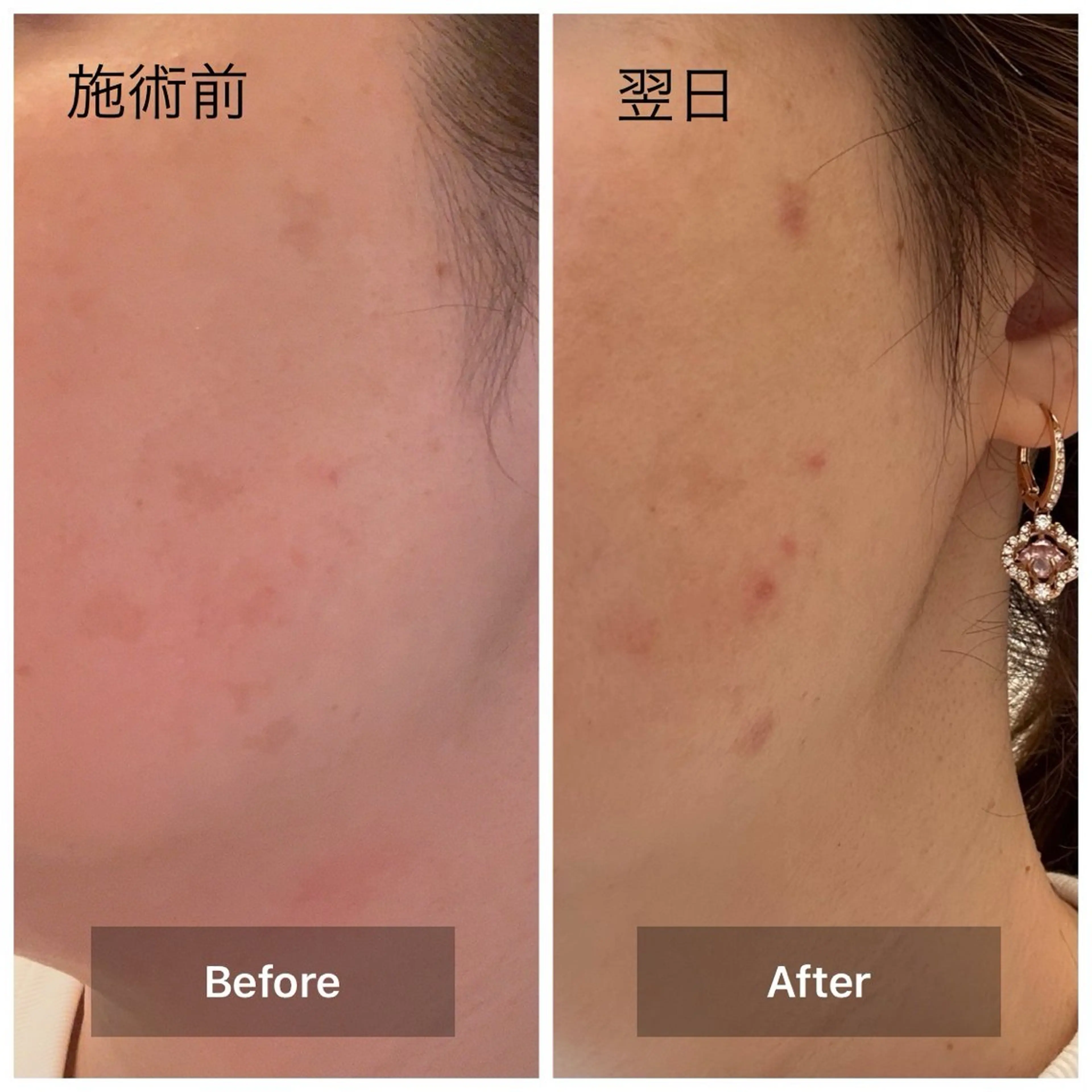 エステ リラク 目元・まつパ・美肌フ ェイシャル谷町四丁目のマツエク・マツパデザイン