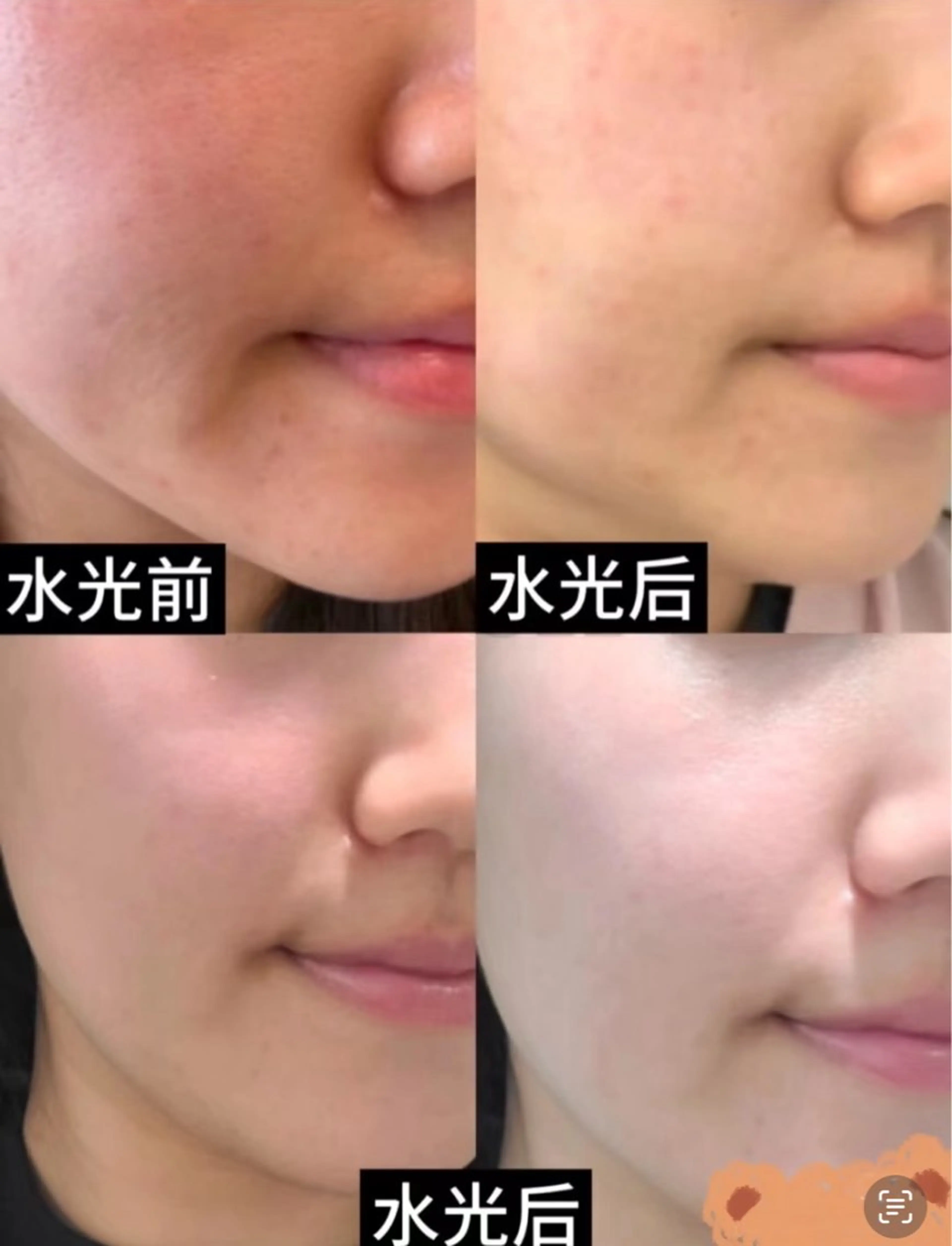 ネイル エステ aliaハイフ&水光ジェットサロン所属・aliaハーブ水光店 エステティシャン募集のエステ・リラクイメージ