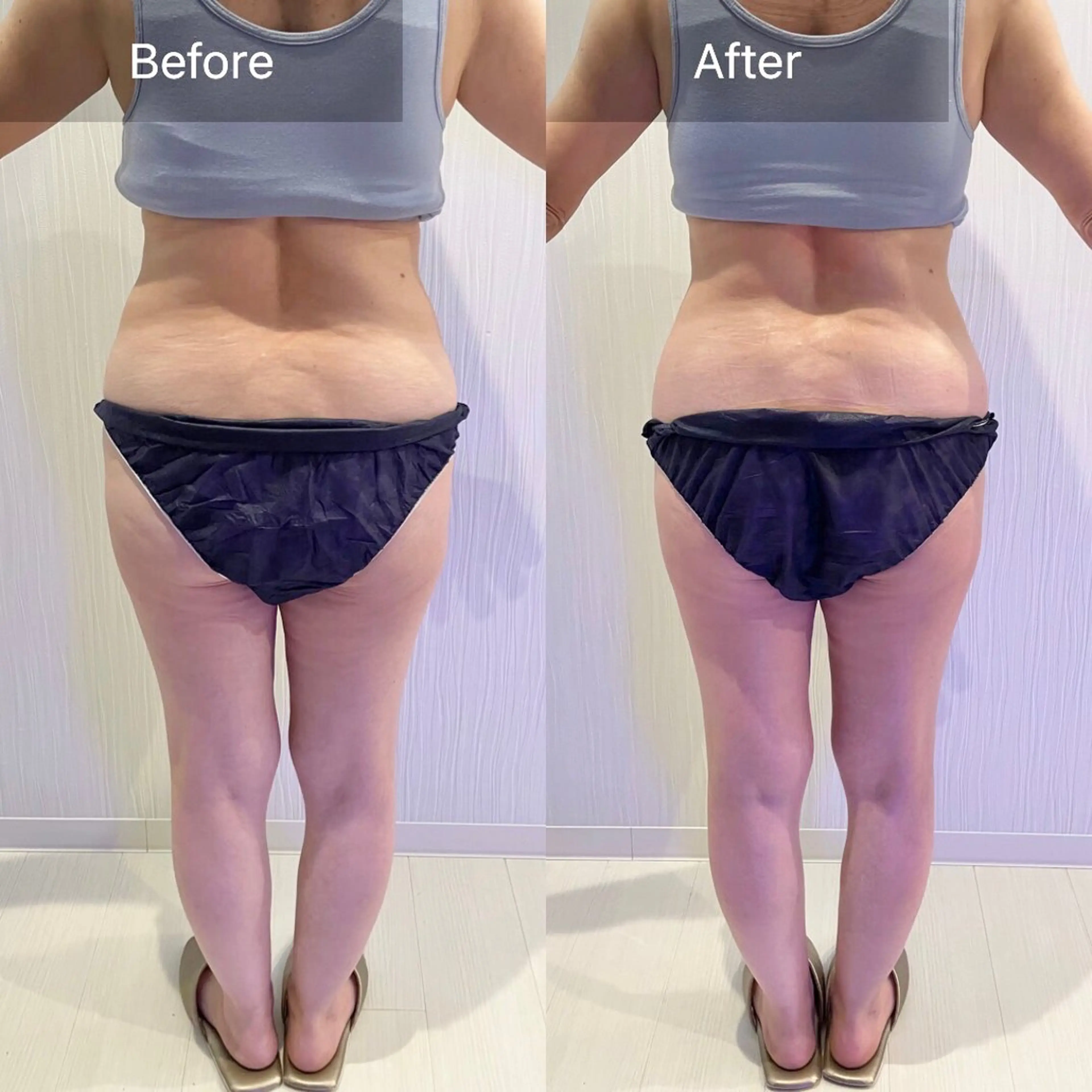 Nature（ナチュレ）所属・【脳洗浄/痩身】 nature東金のエステ・リラクイメージ