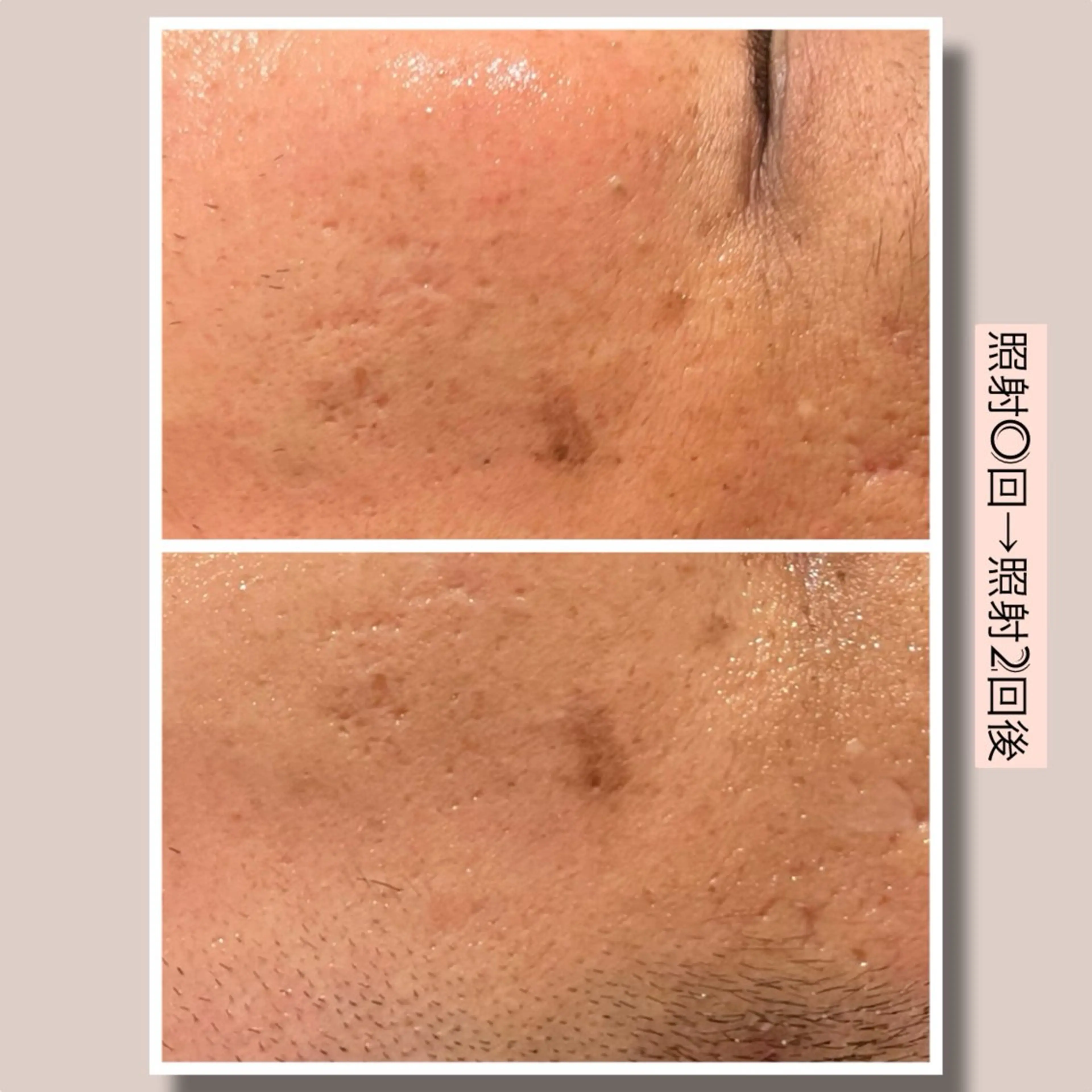 ☆痩身/小顔☆ コルギのエステ・リラクイメージ