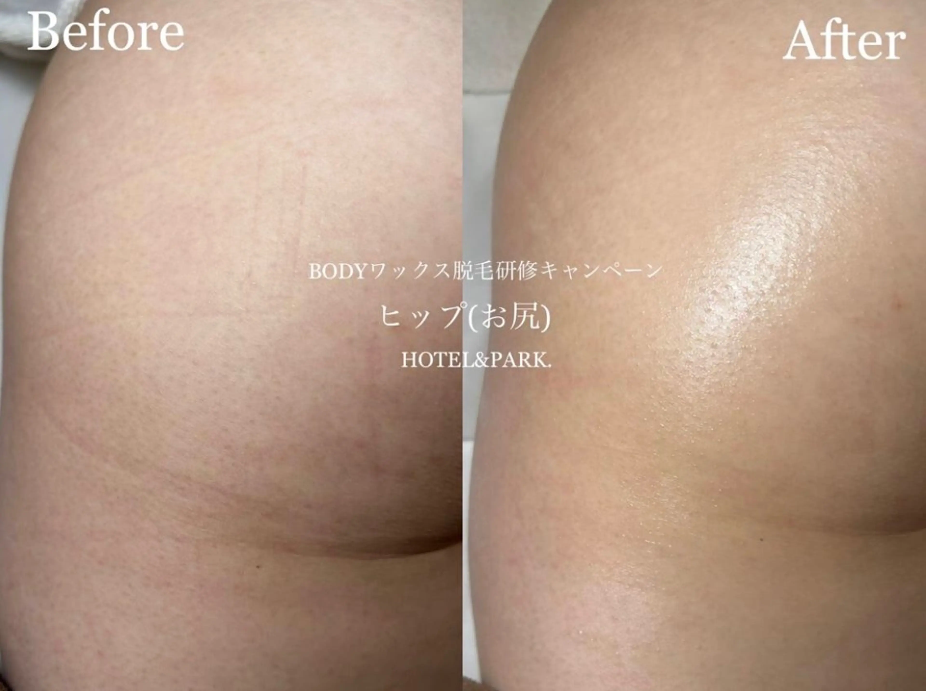 HOTEL&PARK Mikuワックス脱毛のエステ・リラクイメージ