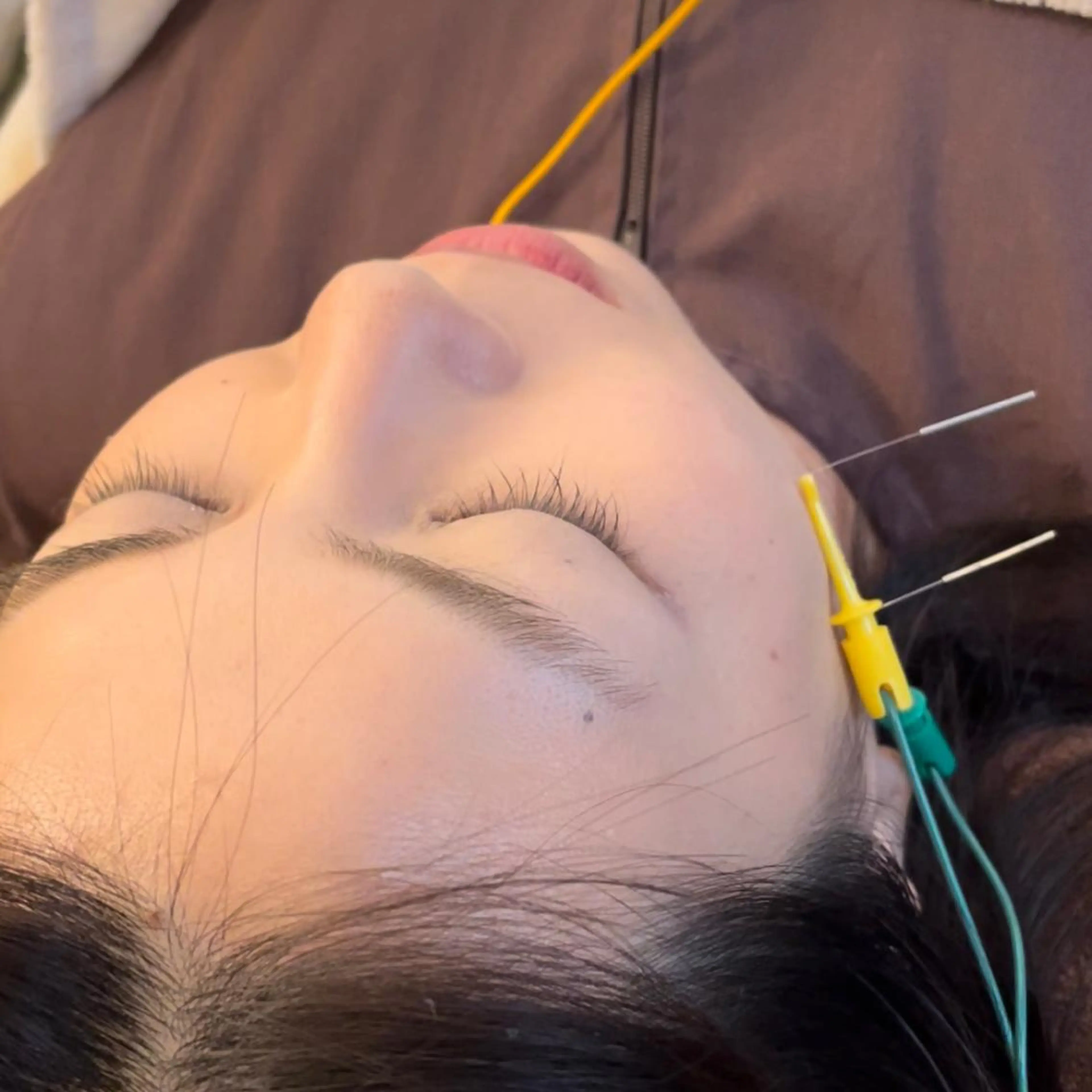 美容鍼　蒼月-aotsuki-所属・美容鍼「蒼月」 -アオツキ-のエステ・リラクイメージ