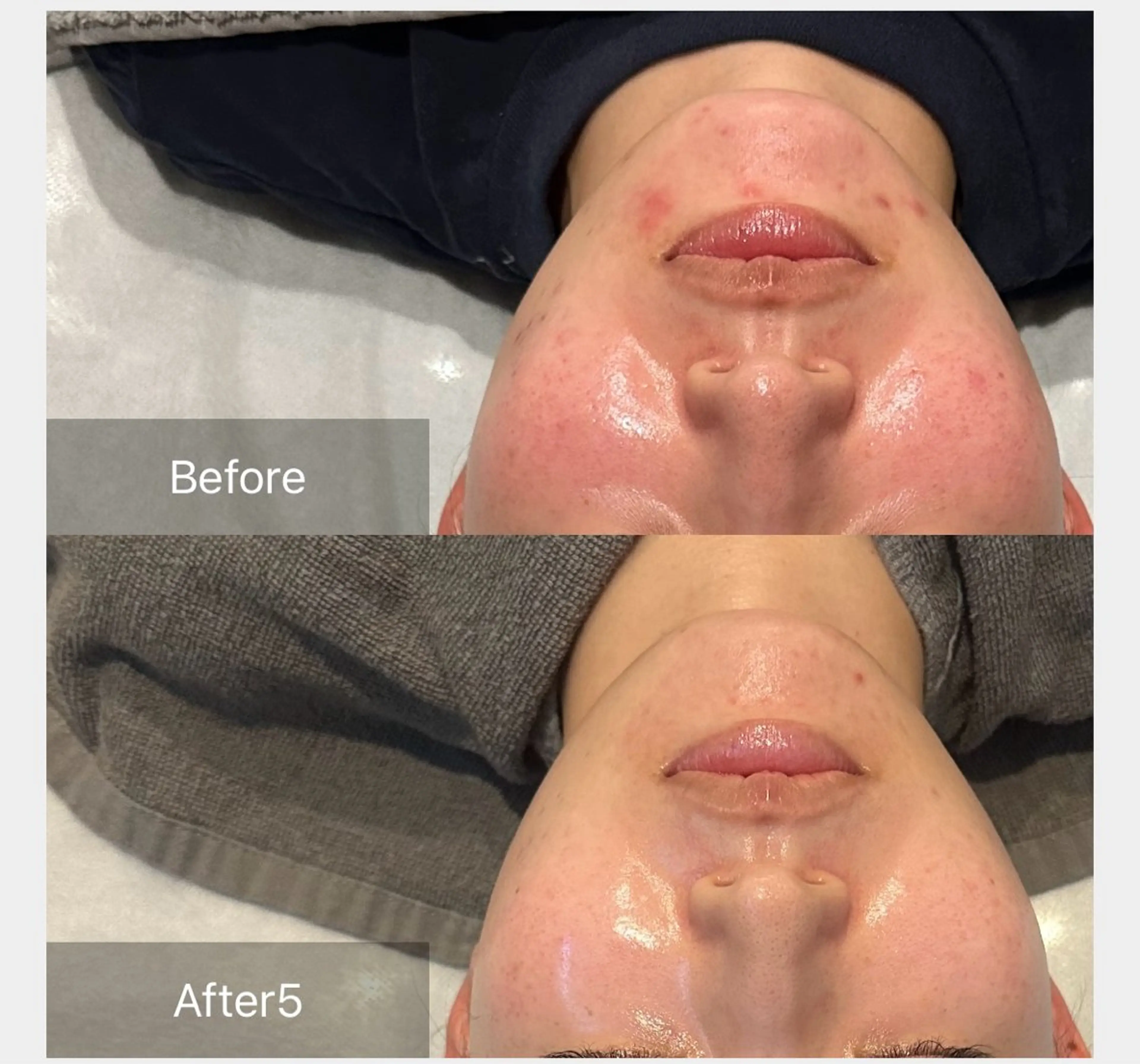 エステ ALIA Scintiller  アリアサンティエ所属・齋藤 祐里耶のエステ・リラクイメージ