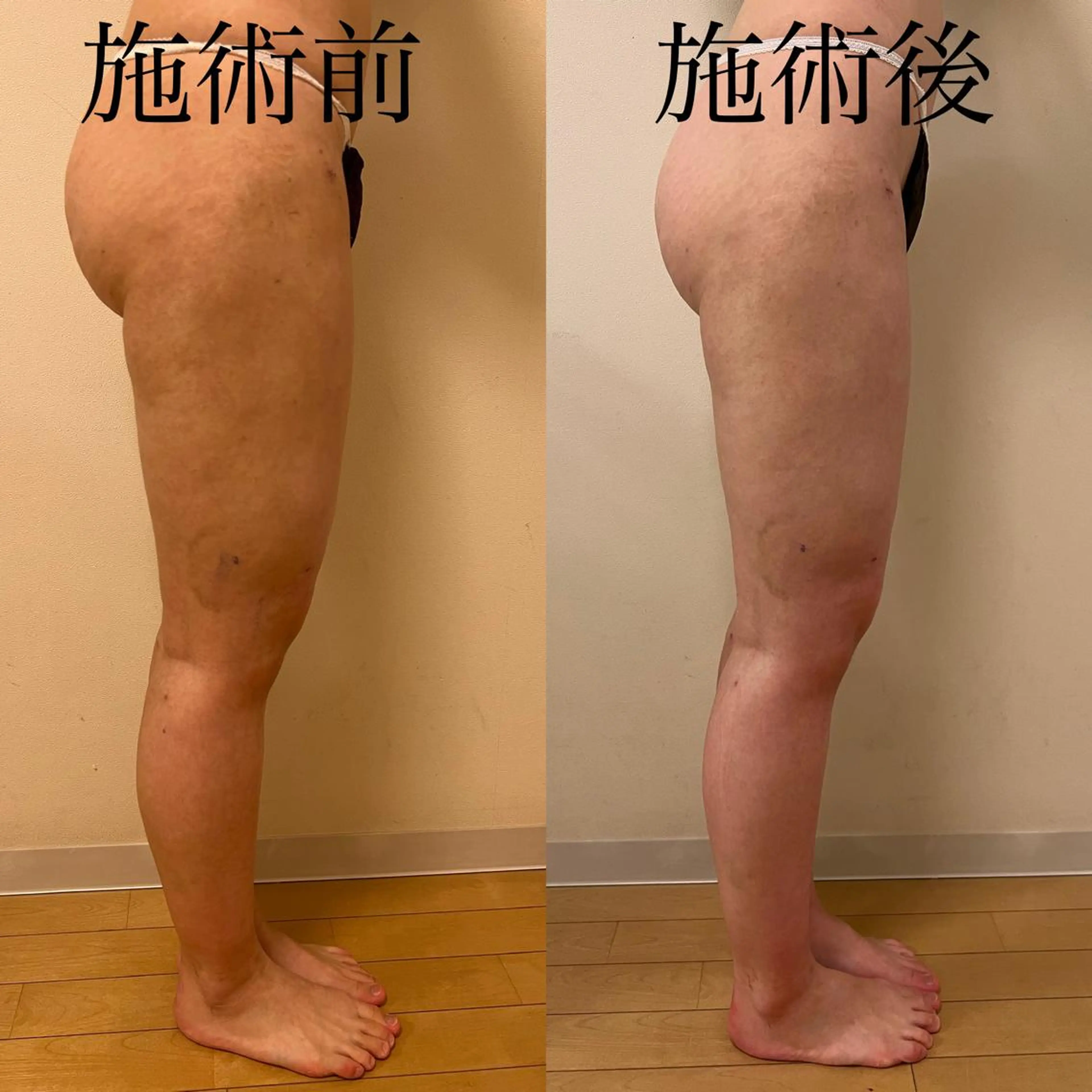 WOM SALON所属・MIKU【美容整形ダ ウンタイムケア銀座】のエステ・リラクイメージ