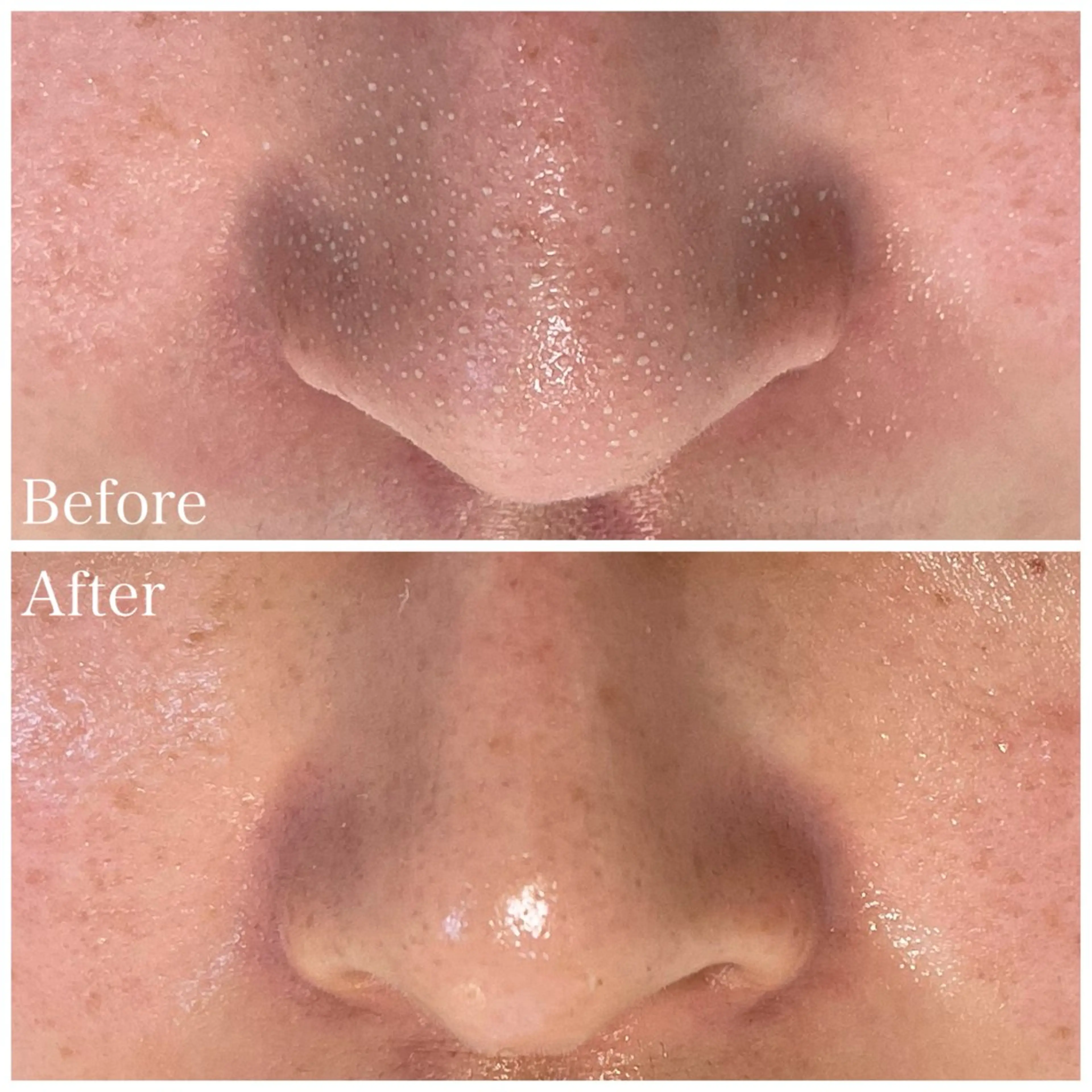 Nna Salon所属・Nna 韓国肌管理のエステ・リラクイメージ