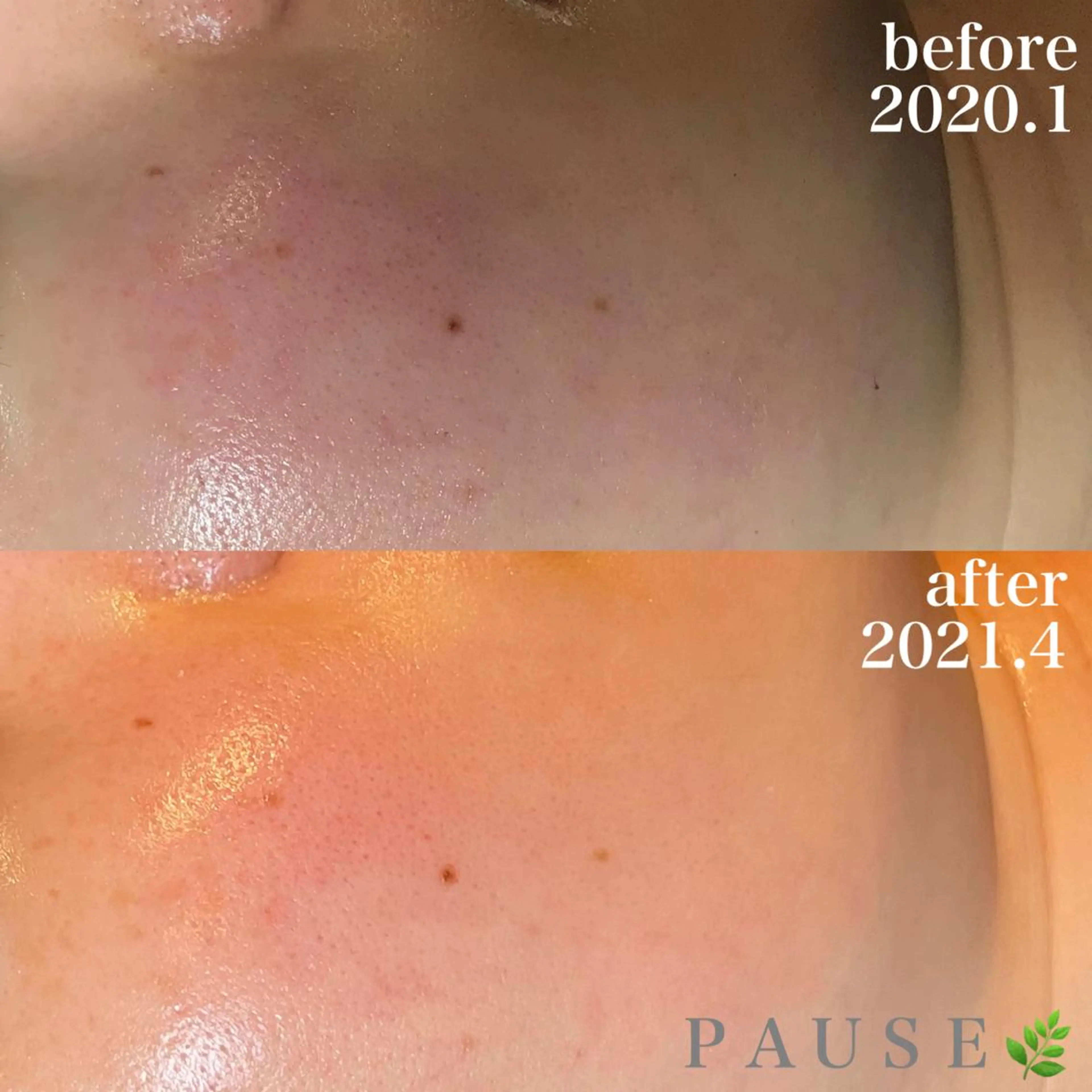 エステ 浜野 恵美のエステ・リラクイメージ