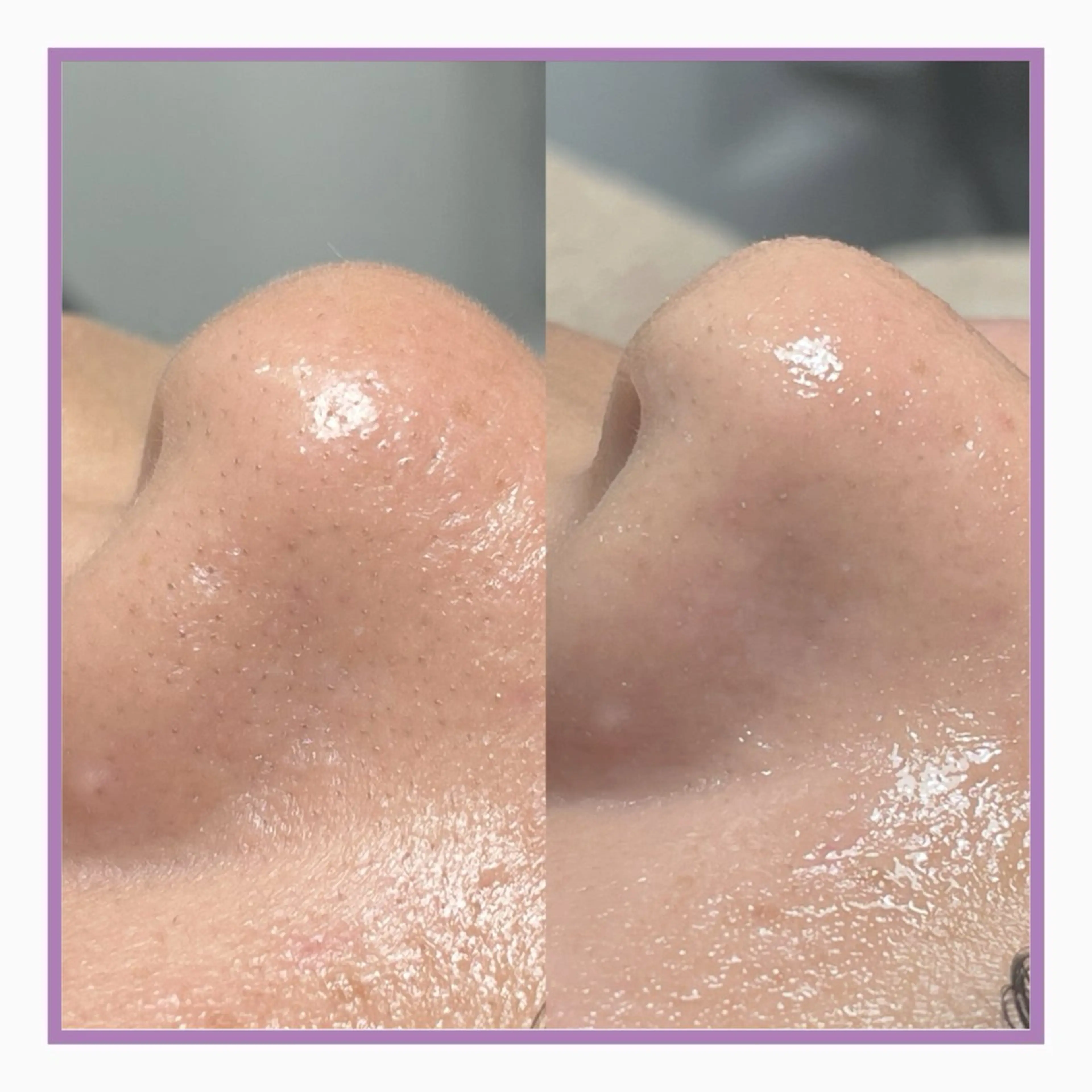 【無料🌼10/28(火)限定】フェイシャルワックスモデル募集🕊産毛・角質ケアでトーンアップ＆化粧ノリUP💕の写真