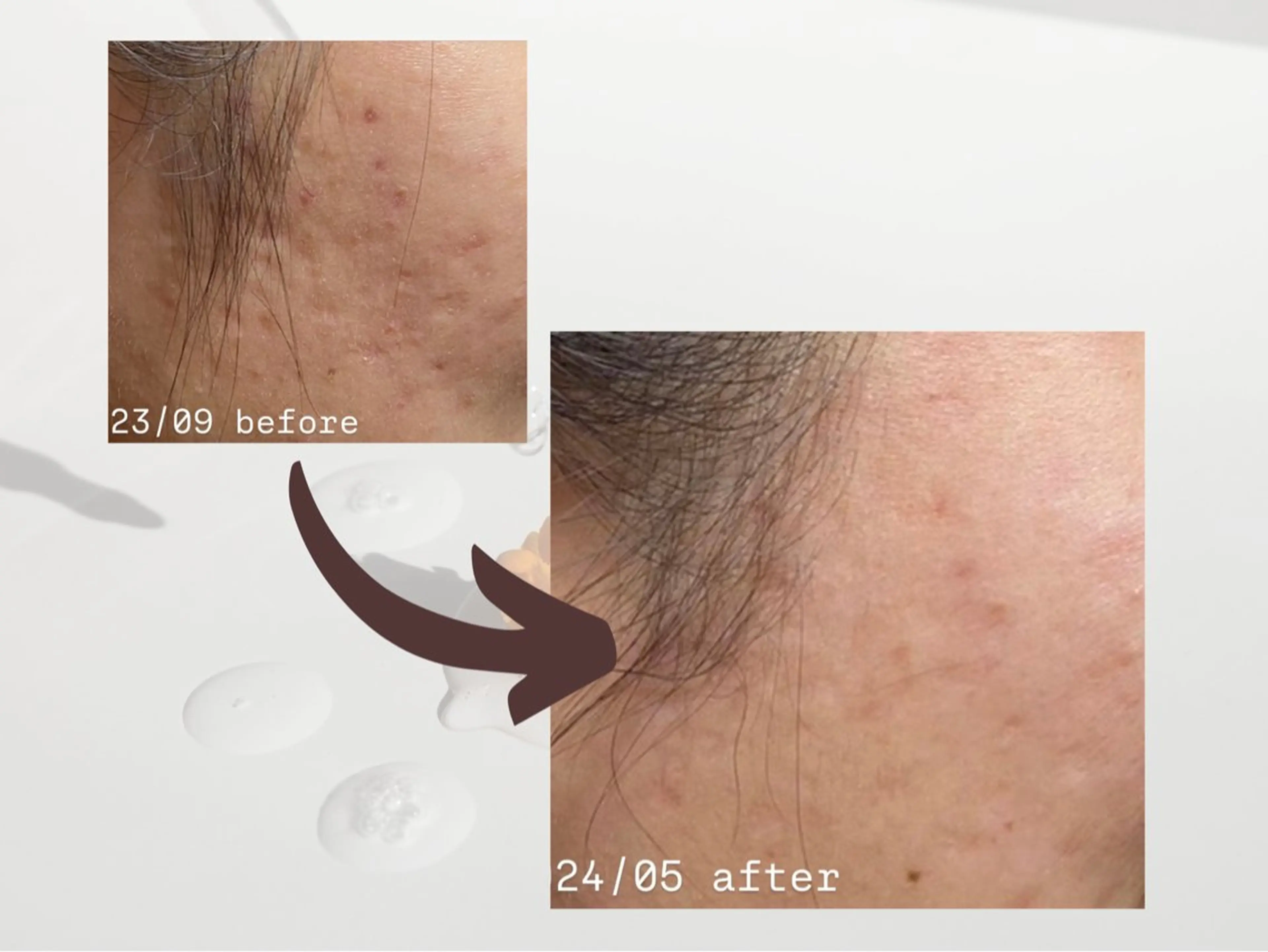 エステ 肌質改善|天王寺 For...はるかのエステ・リラクイメージ