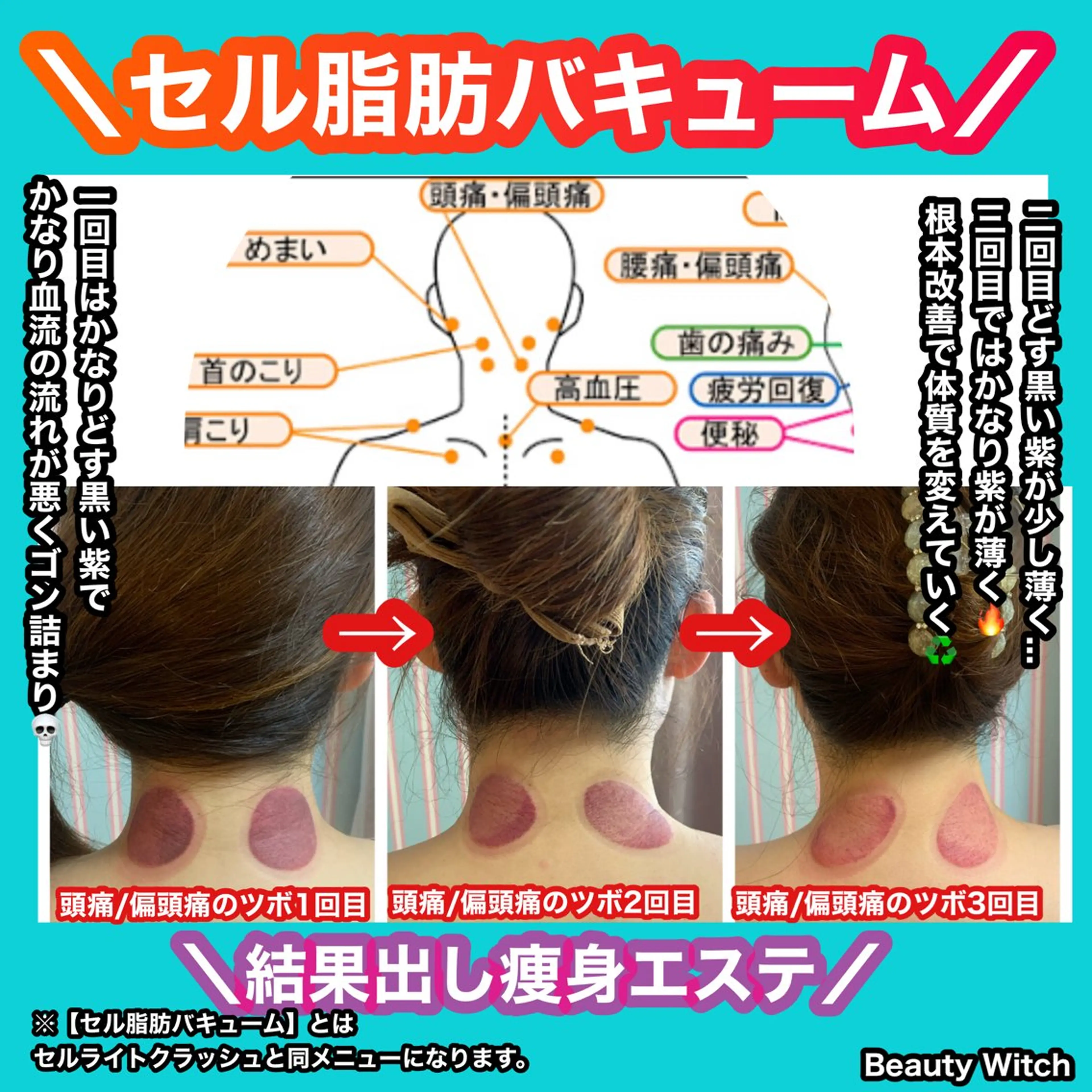 痩身/脱毛/ネイル HARUKAのエステ・リラクイメージ