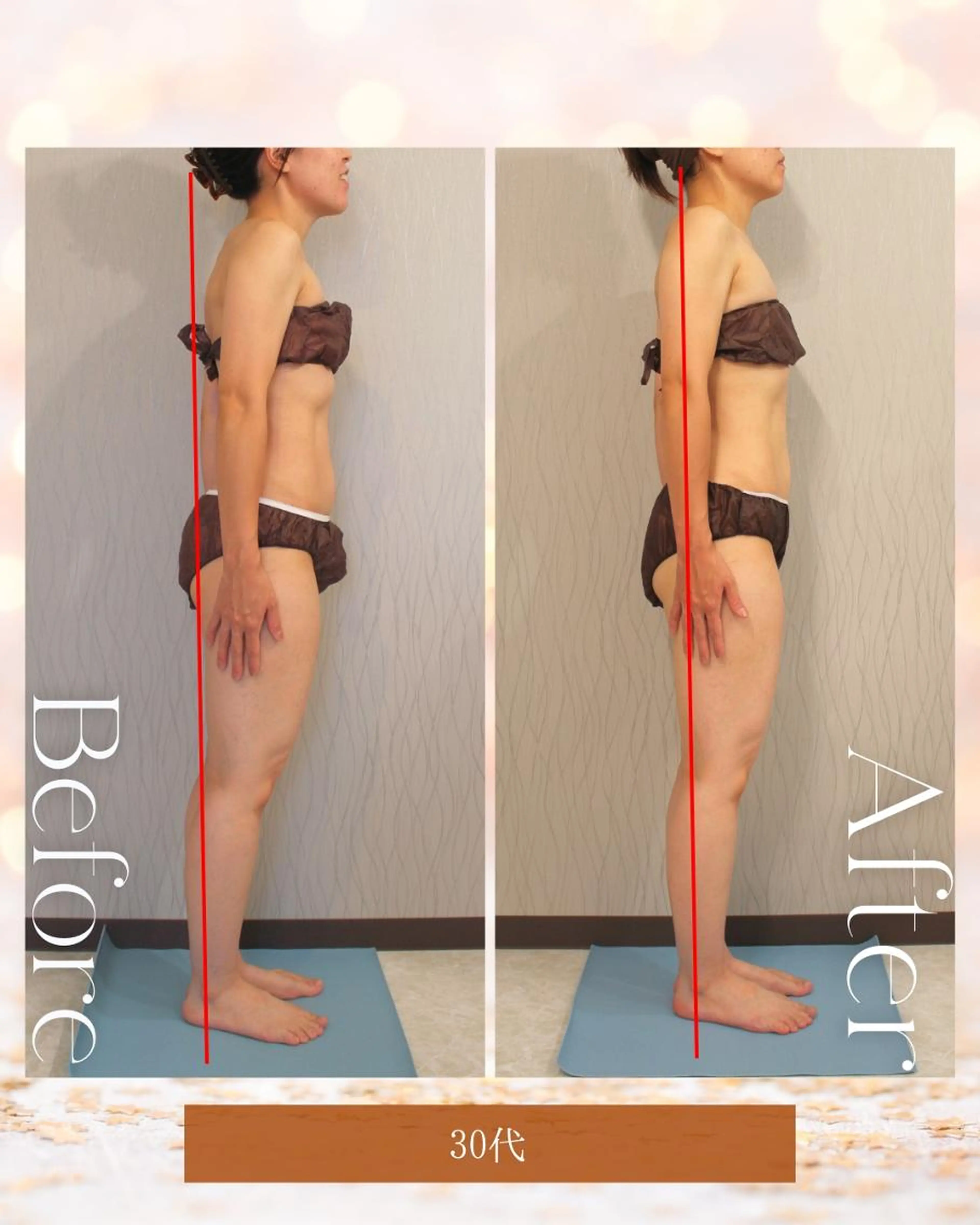 【猫背ケアして美姿勢に！】骨格調整＆デトックス全身リンパモニターの写真