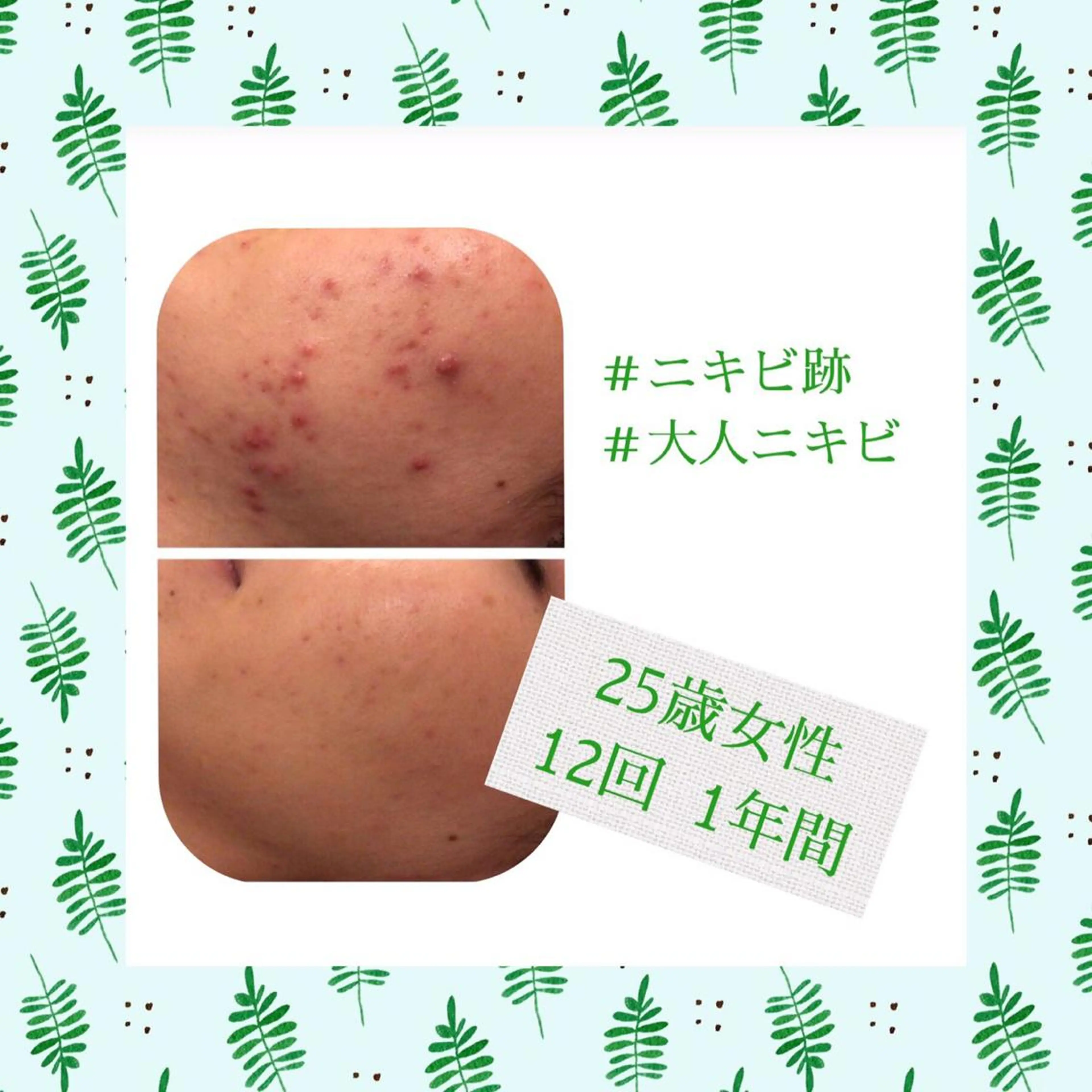 ミディアム カラー パーマ ヘアアレンジ メンズ キッズ ネイル マツエク・マツパ エステ リラク ニキビ・肌質改善専門 ♡人生が変わるサロンのエステ・リラクイメージ