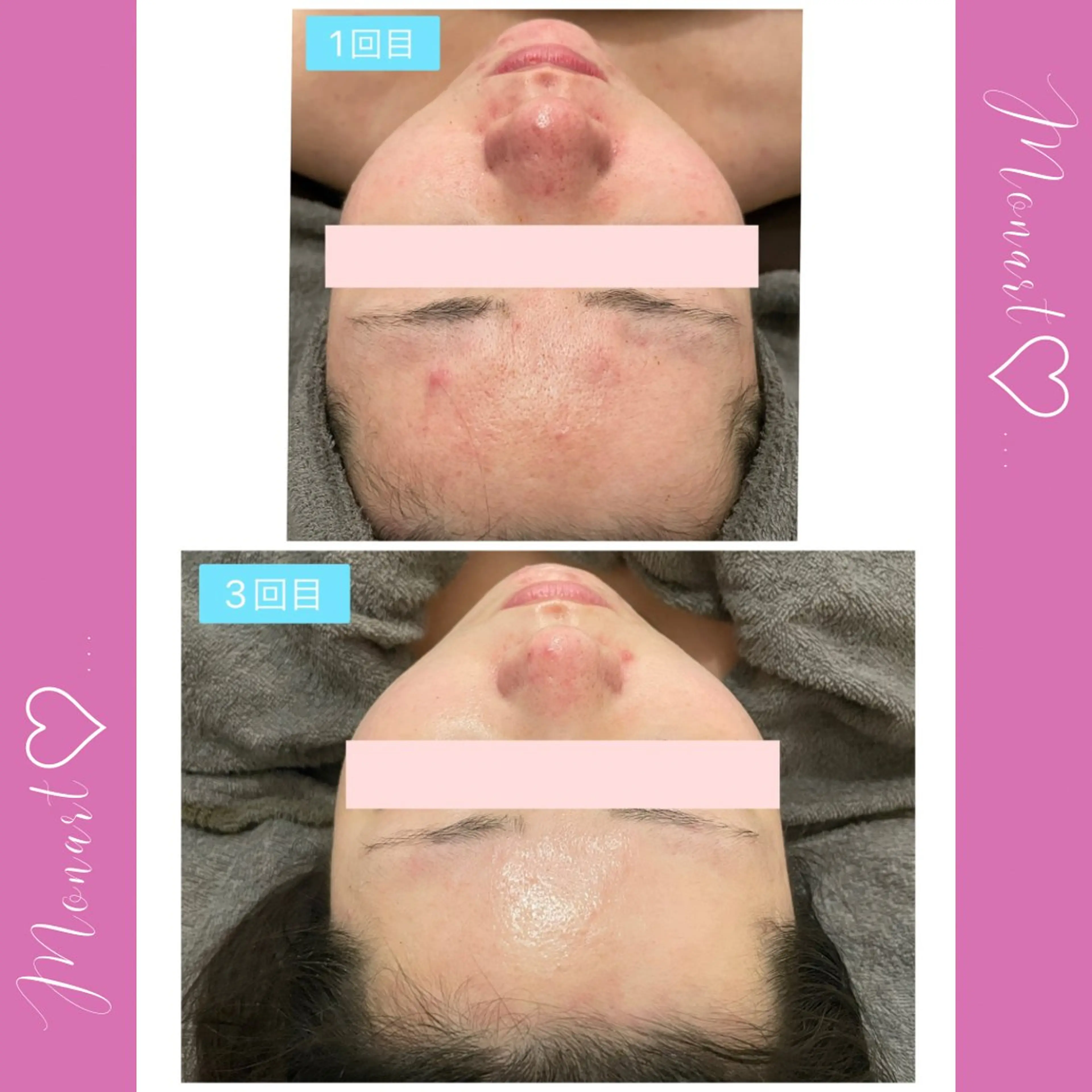 Monart -deux-のエステ・リラクイメージ