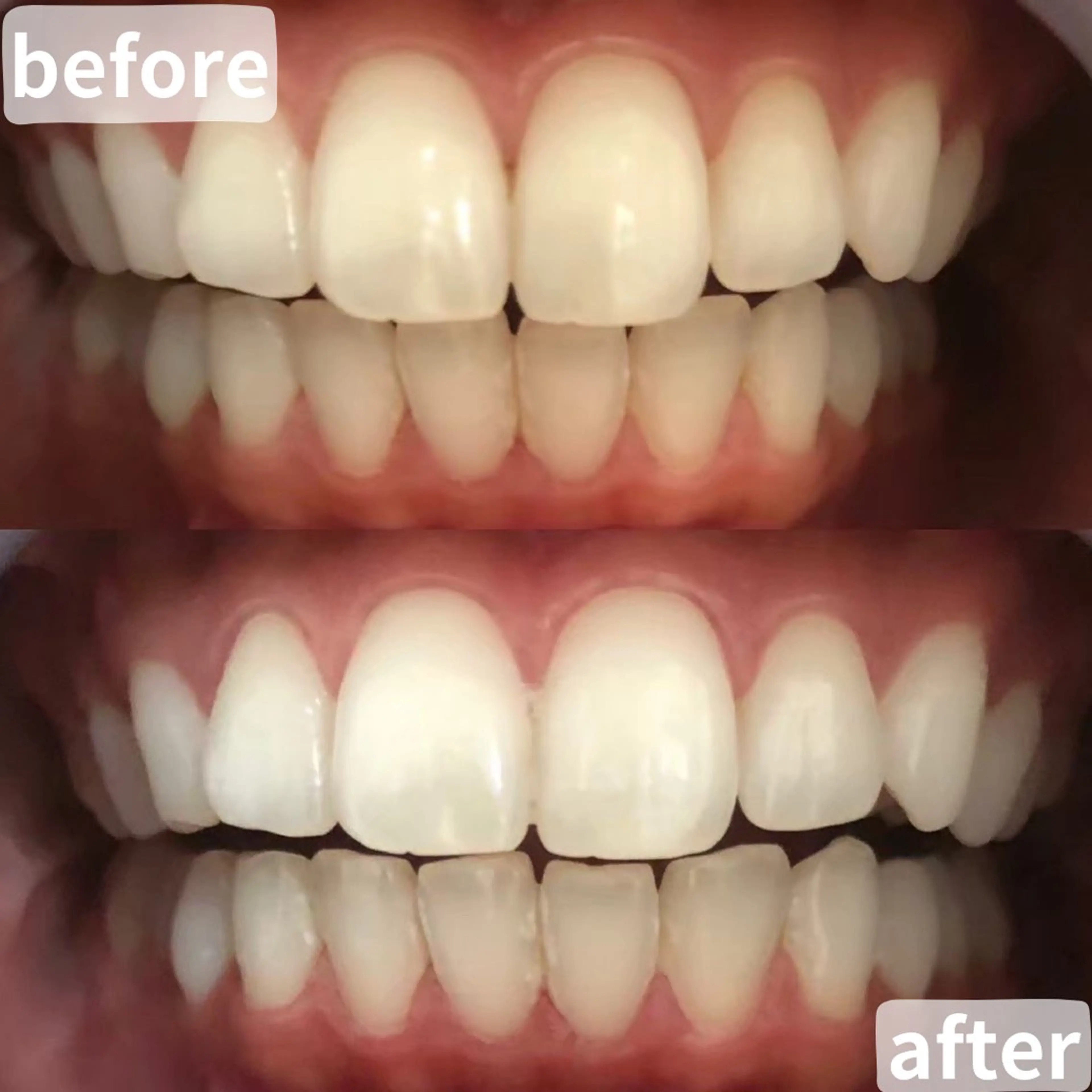 LBSホワイトニング桶川店所属・LBSホワイトニング 桶川店のその他イメージ