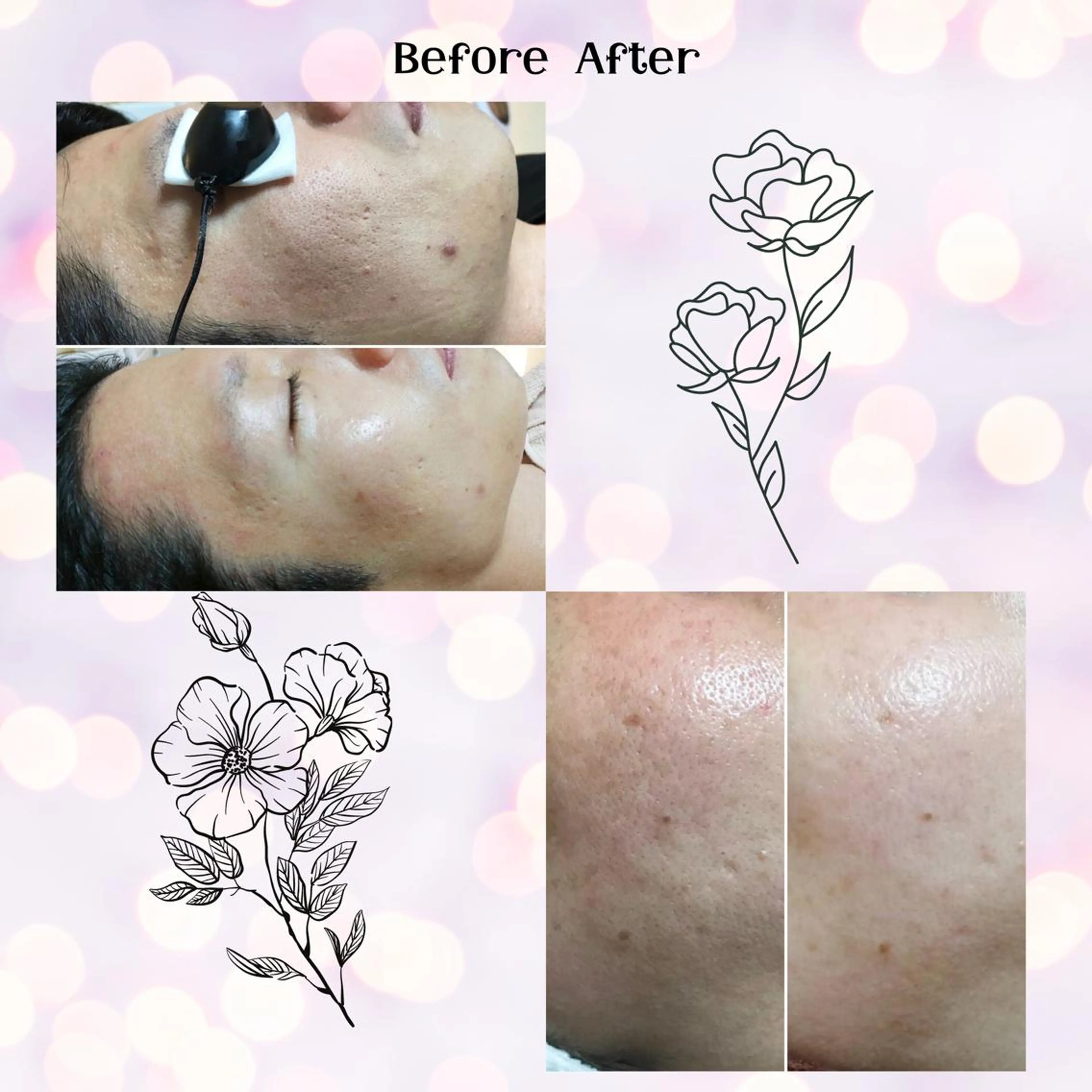 メンズ 男女同額完全個室脱毛 LEPIA内田のエステ・リラクイメージ