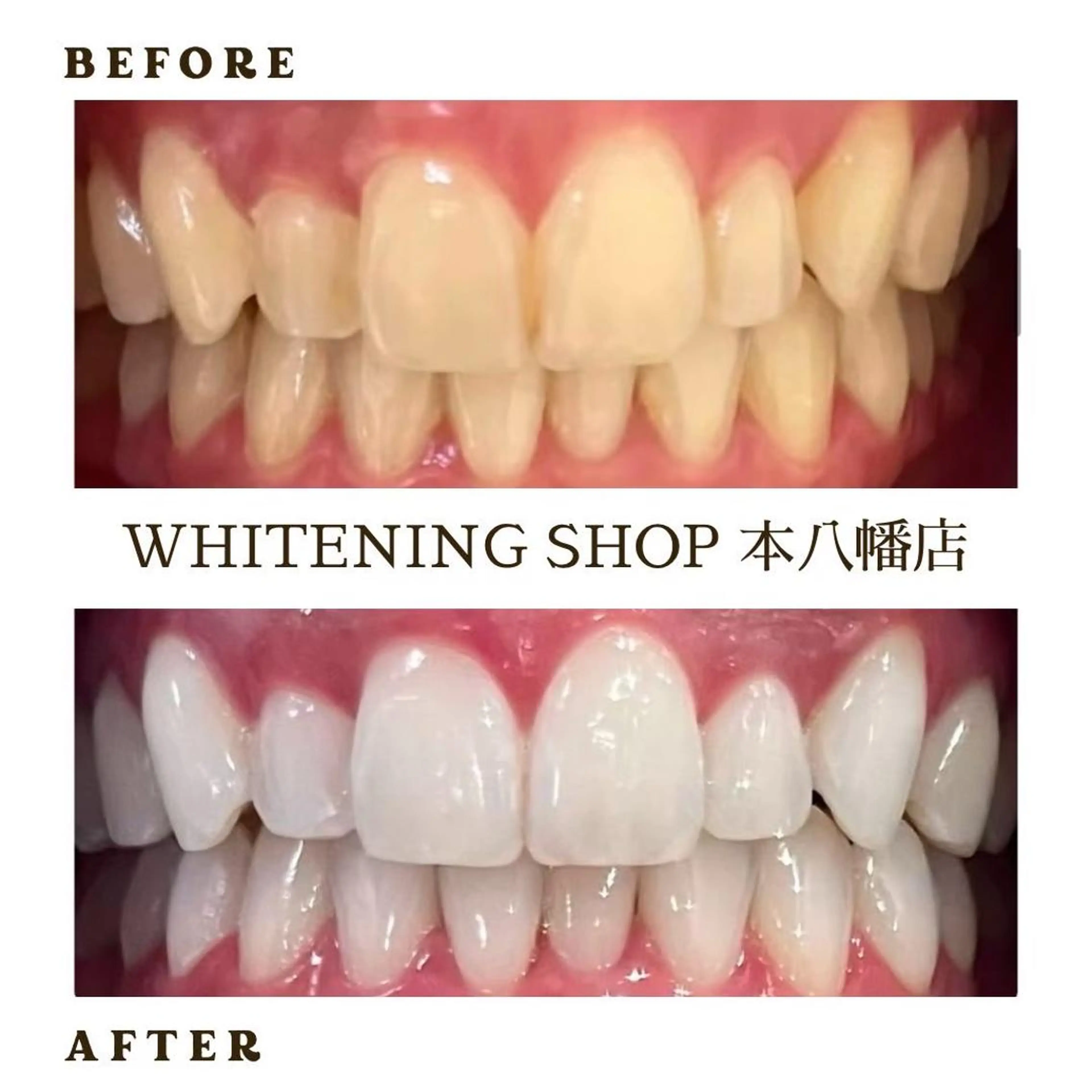 メンズ エステ リラク ホワイトニング ショップ本八幡店のエステ・リラクイメージ