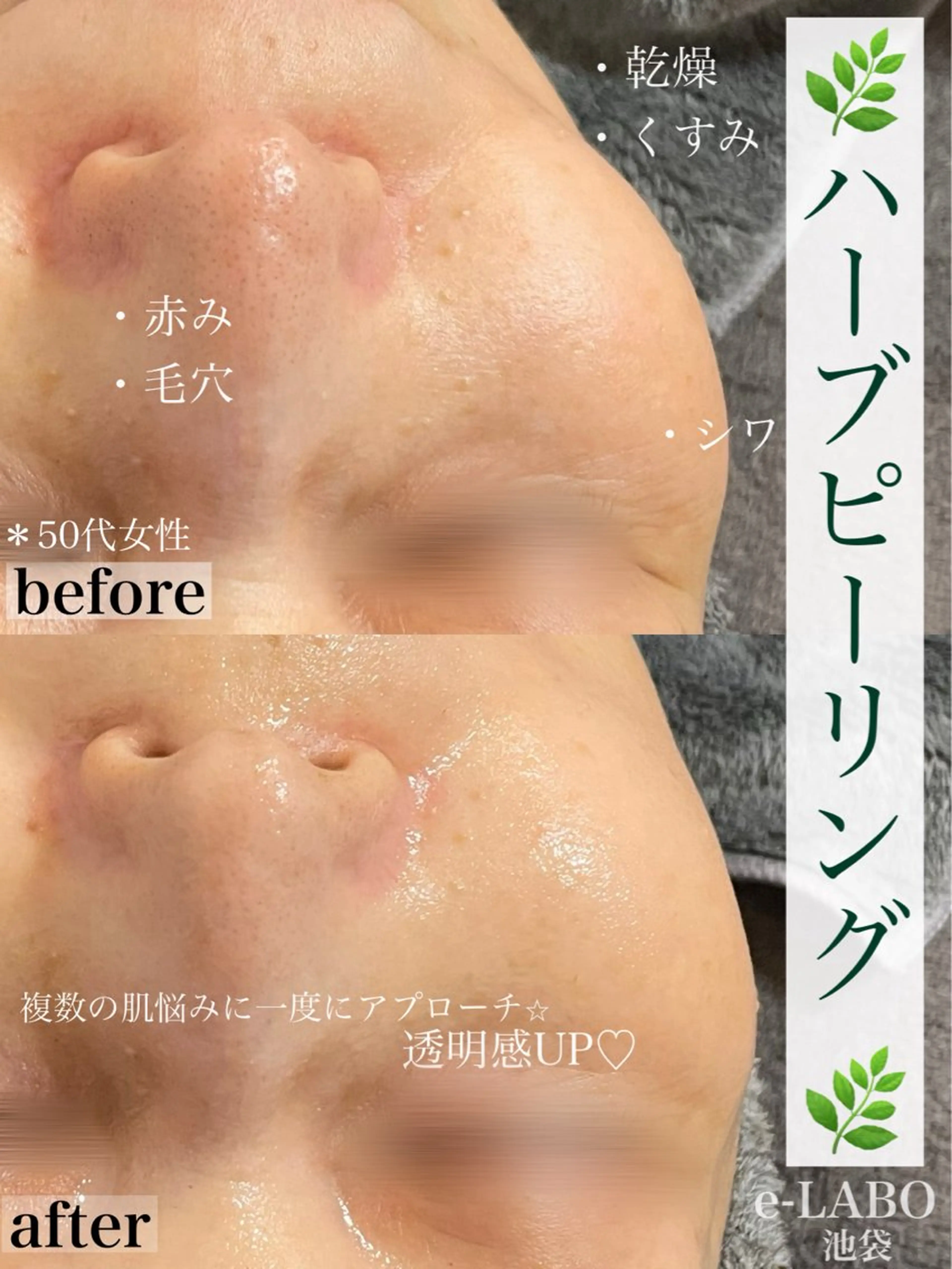 e-LABO こいずみのエステ・リラクイメージ