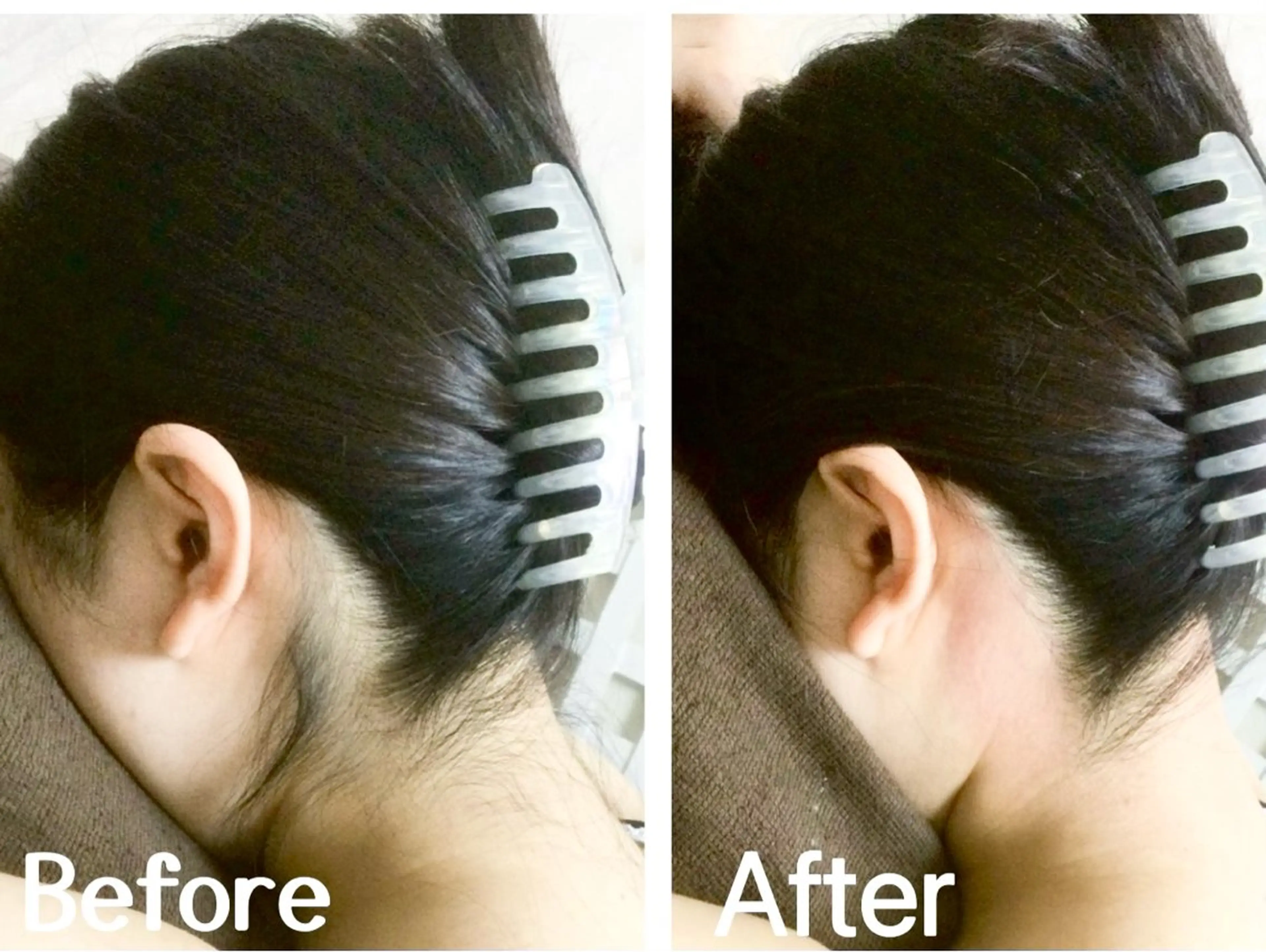 川越ローマピンク 光脱毛＆ワックス脱毛のエステ・リラクイメージ