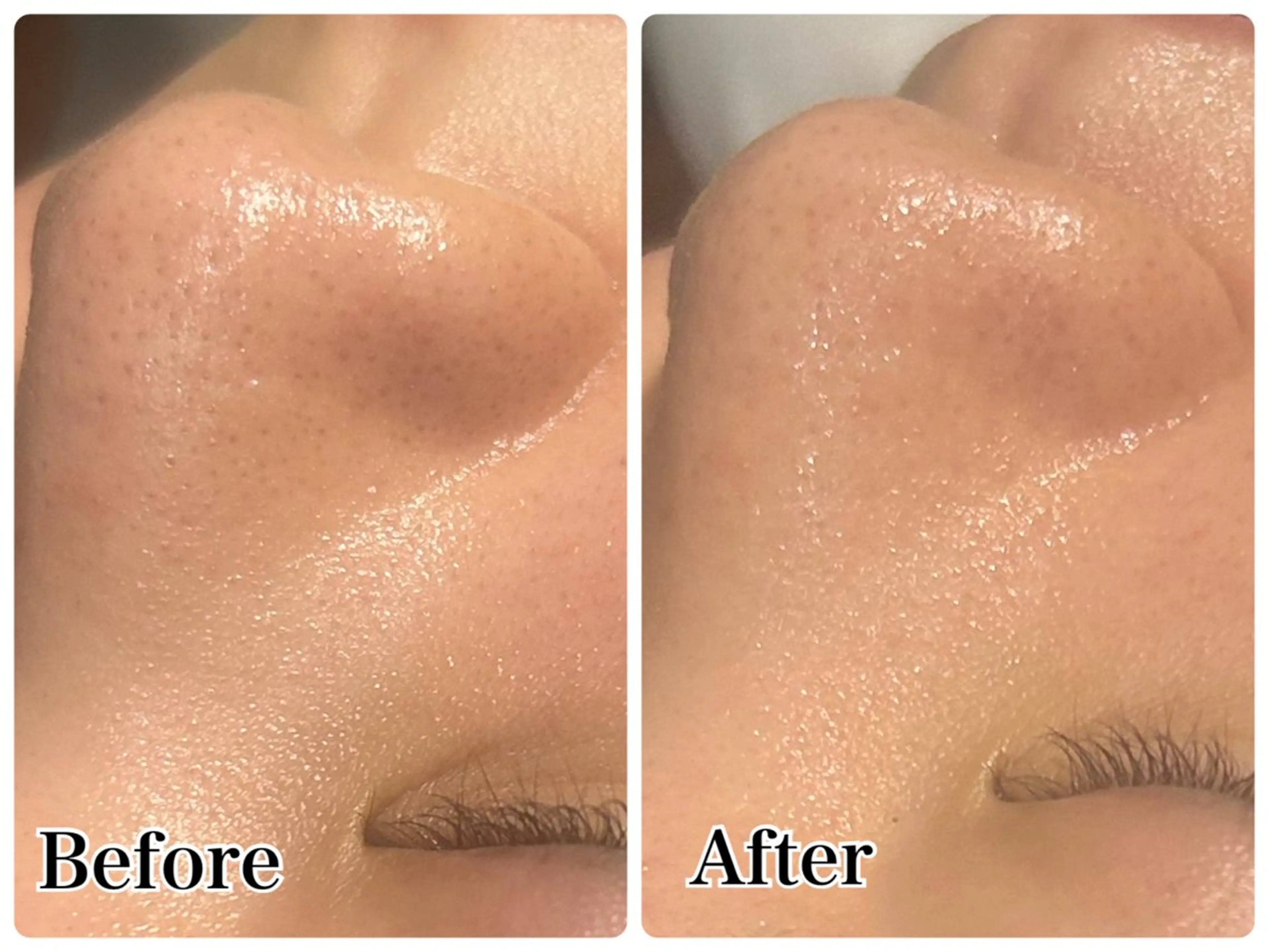 エステ Gemini 　MIKIのエステ・リラクイメージ