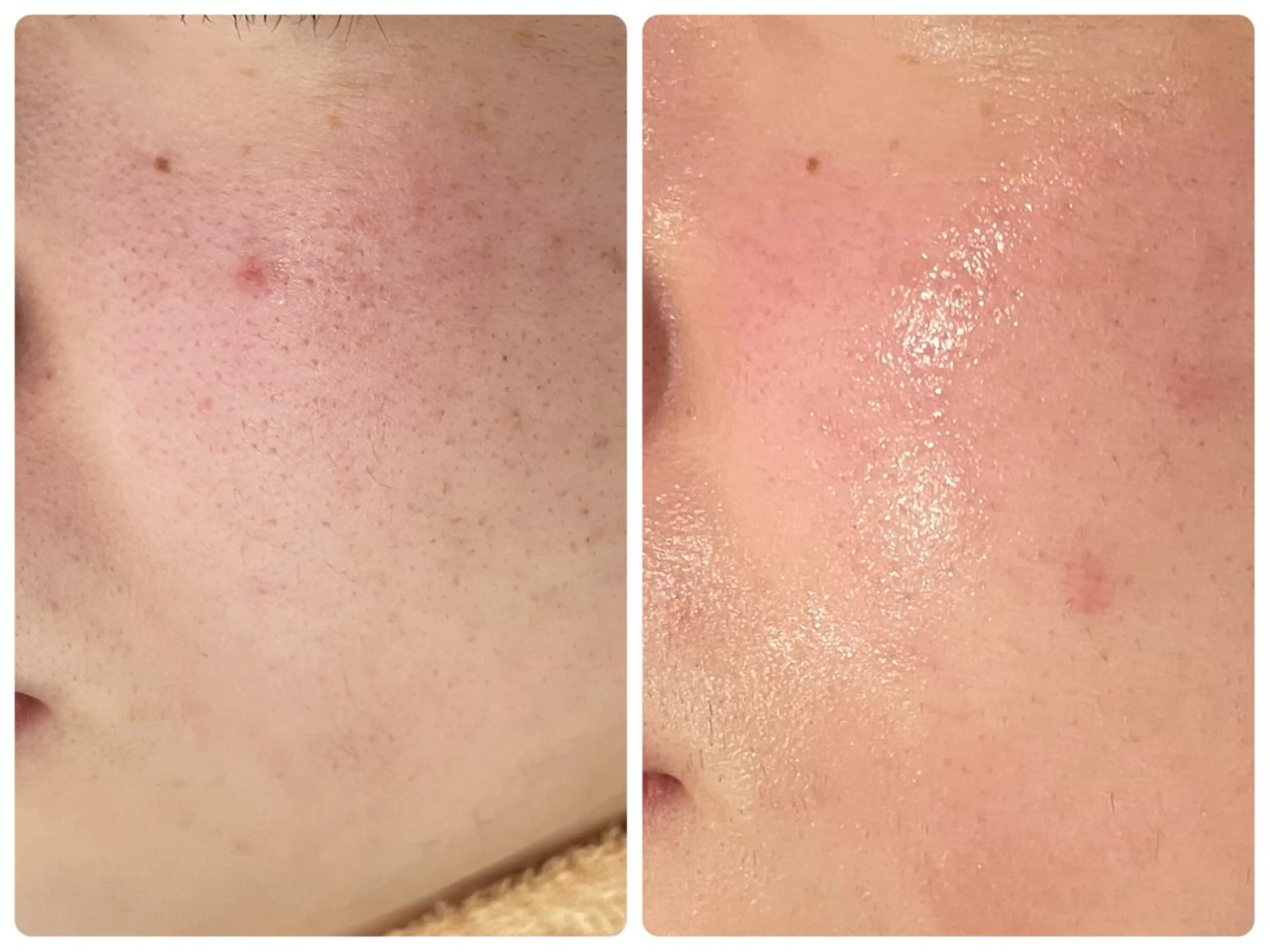 エステ total beauty TLIENGLE［ﾄﾘｱﾝｸﾞﾙ］所属・tliengle ［ﾄﾘｱﾝｸﾞﾙ］のネイルデザイン