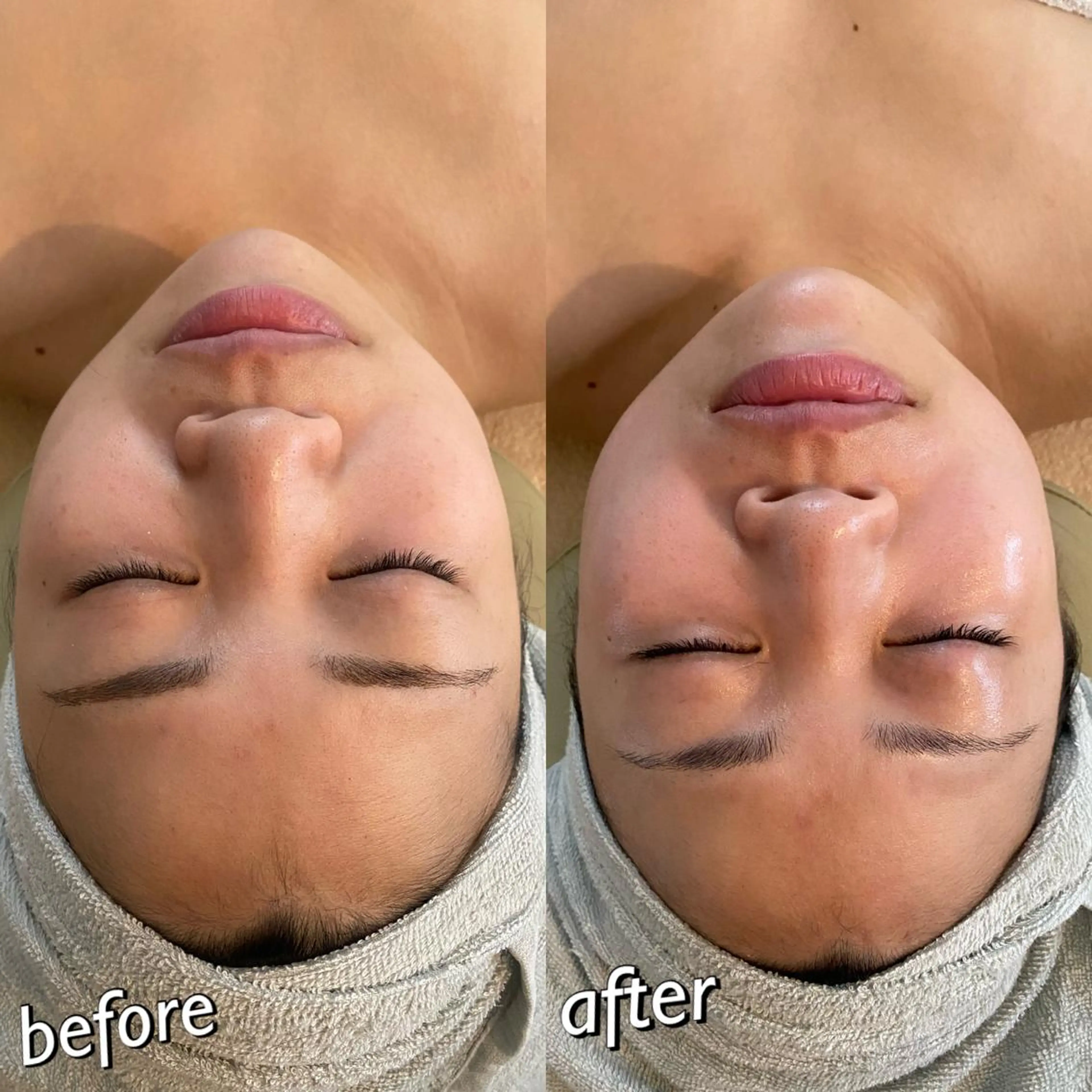 うなじ脱毛/美肌脱毛 LABELのエステ・リラクイメージ