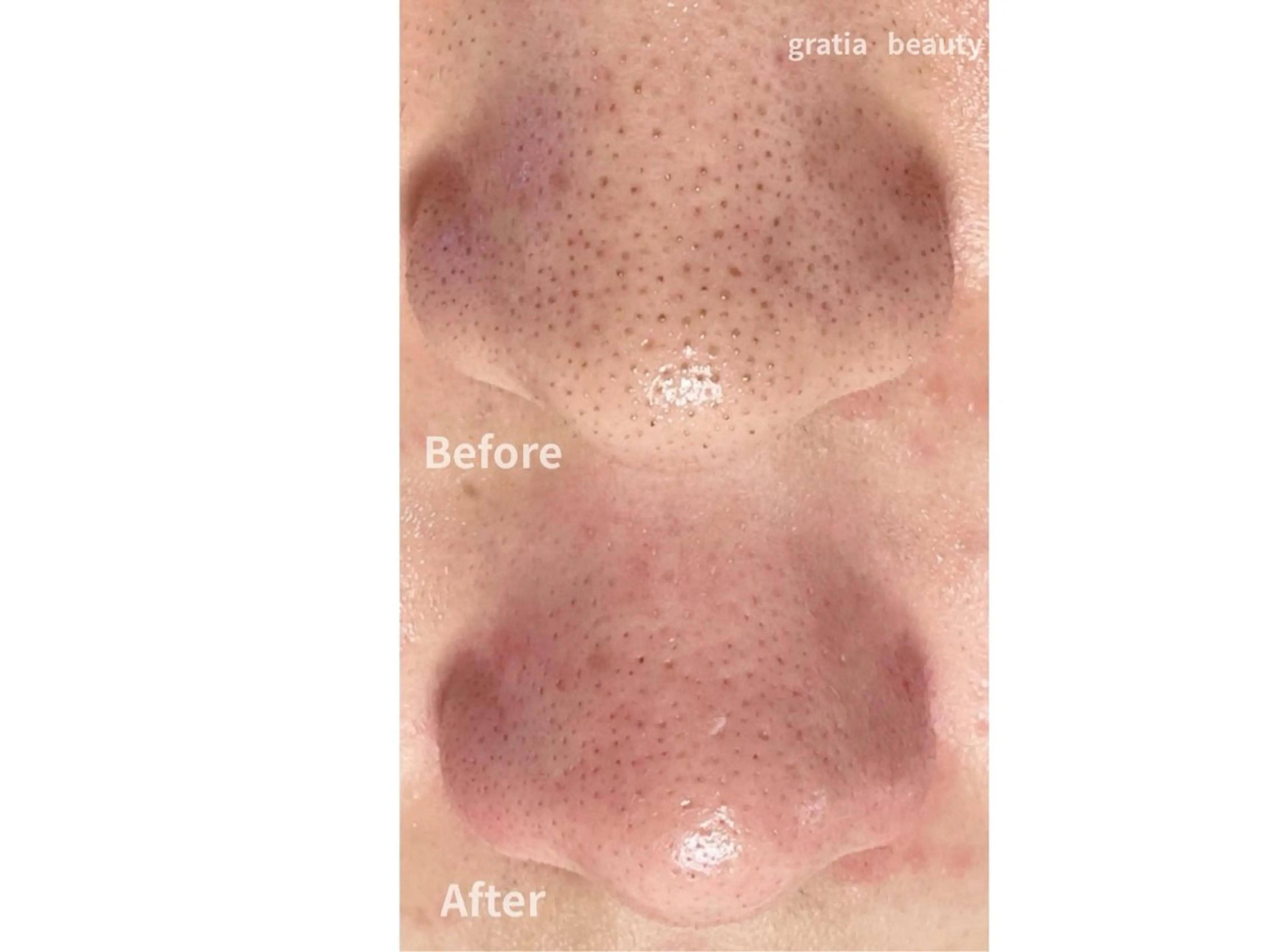 エステ gratia  eyelash&nail所属・gratia salonのその他イメージ