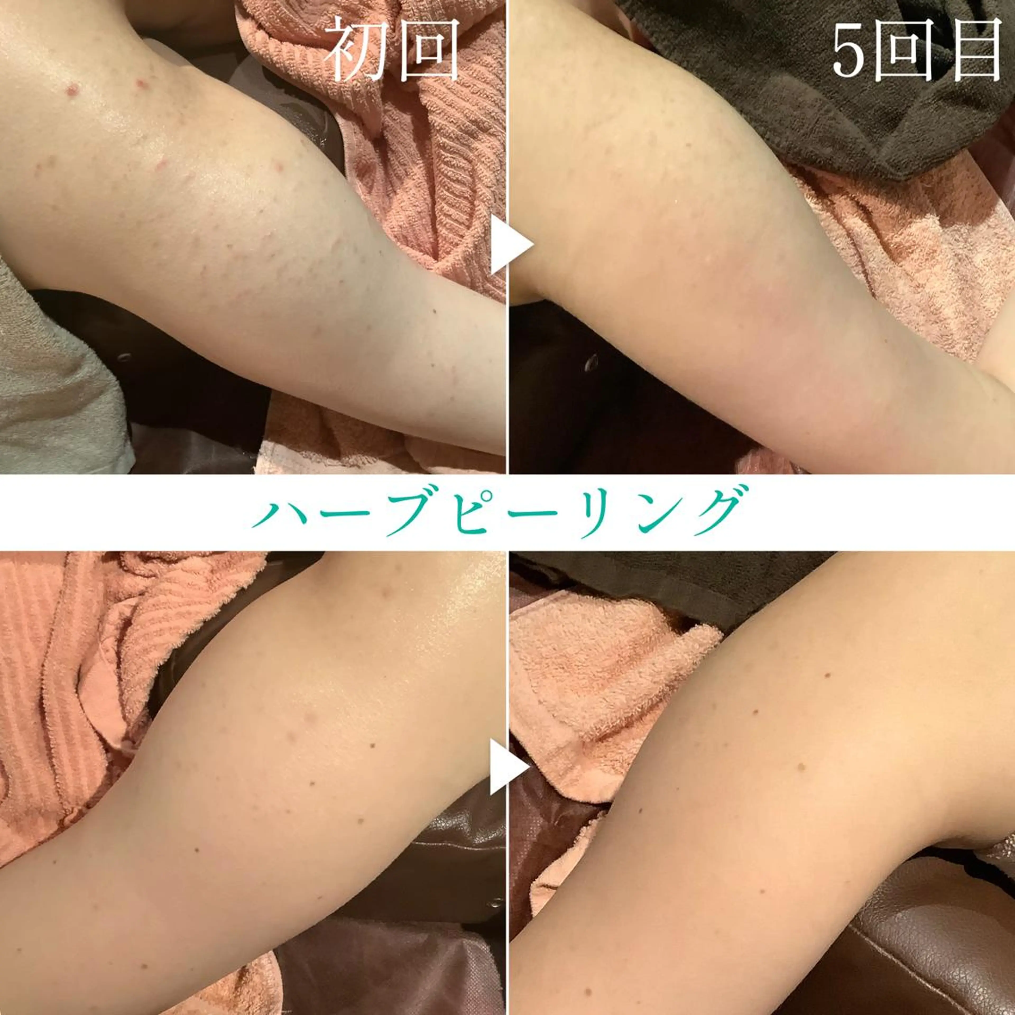 脱毛&エステサロン JIGGLY武蔵小山のエステ・リラクイメージ