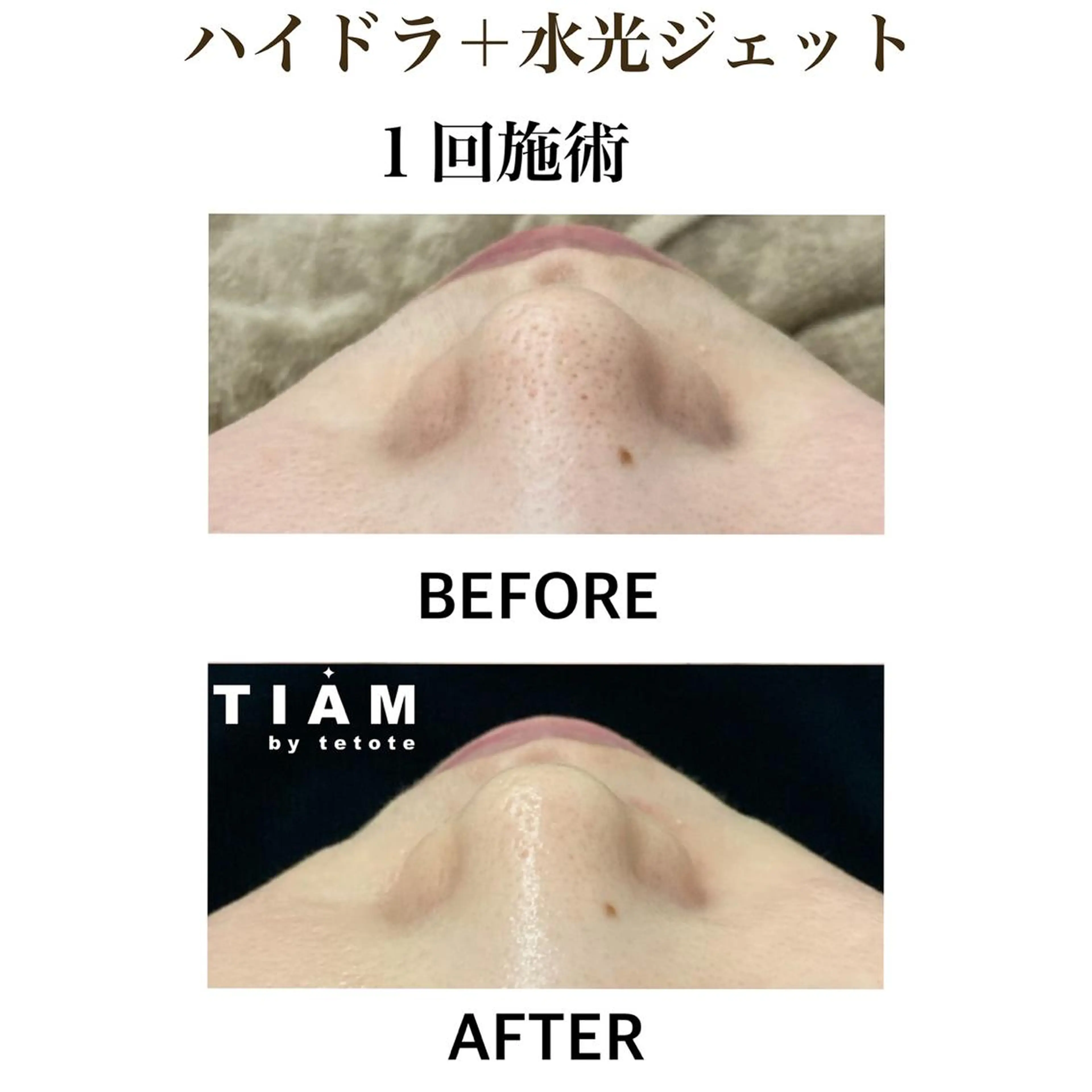 美肌サロンTIAM by tetoteのエステ・リラクイメージ