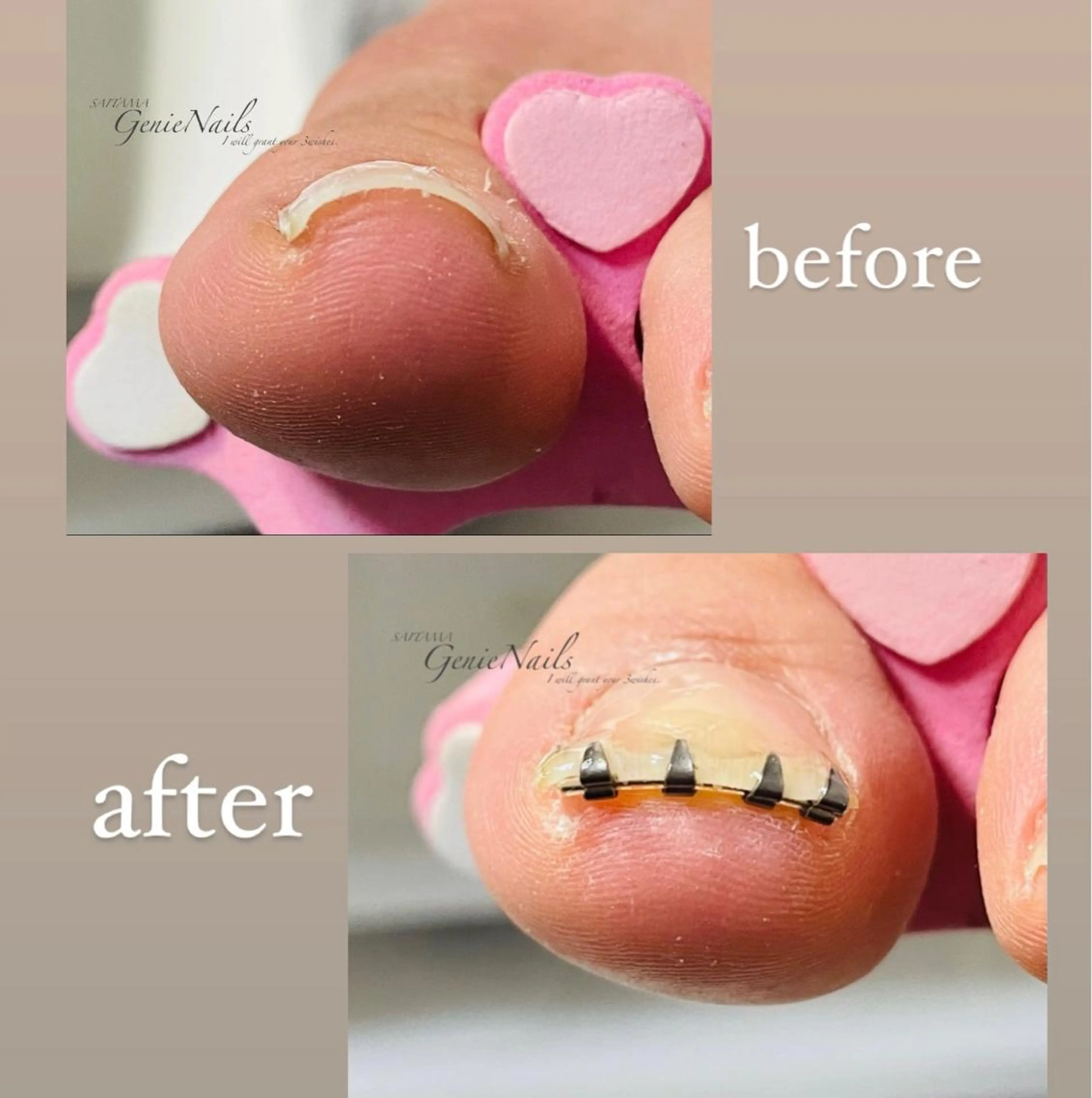 メンズ ネイル フットネイル メンズネイル オフィスネイル ショートネイル 冬ネイル Genie Nailsのネイルデザイン