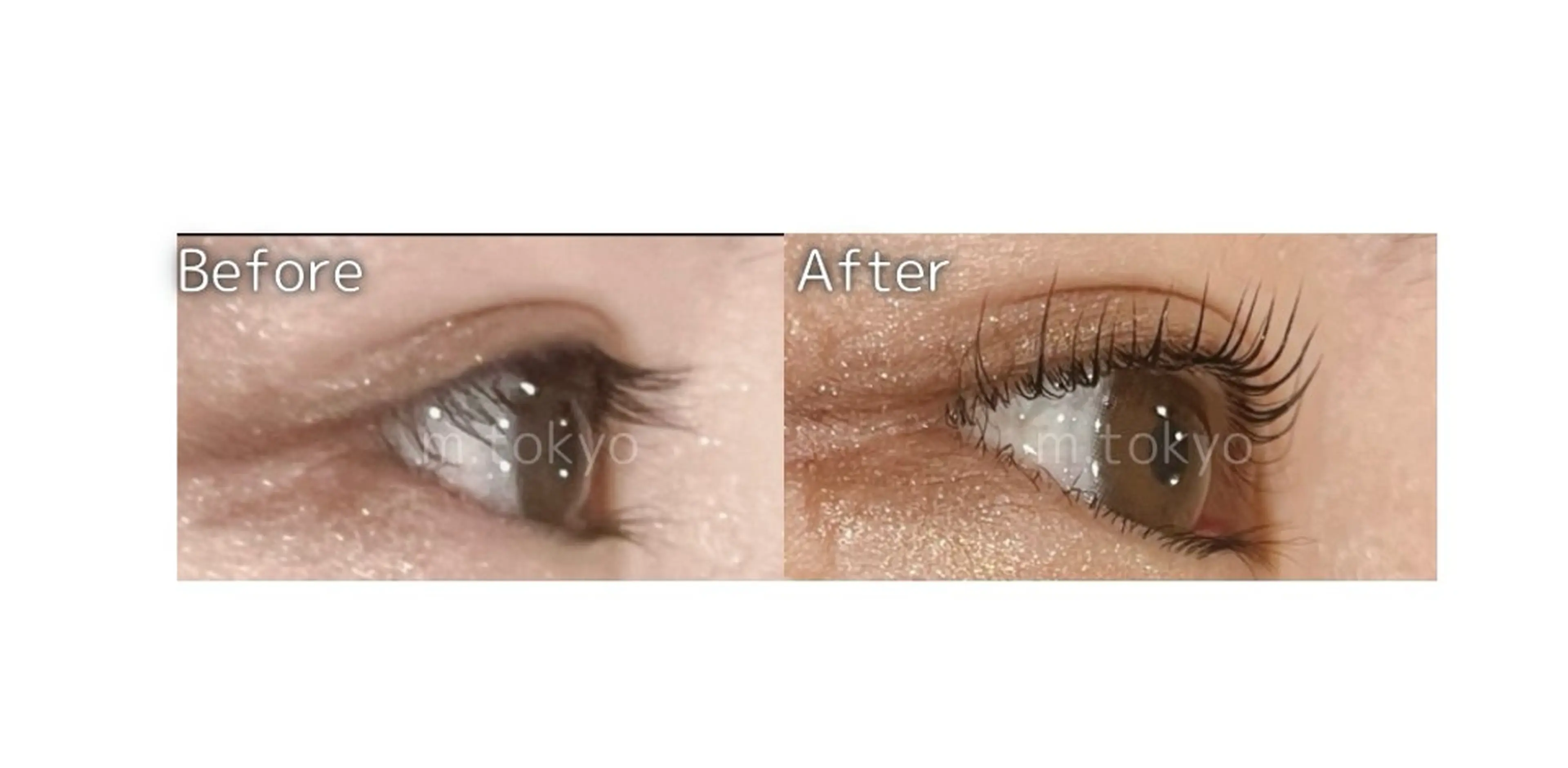 76%OFF！✨何度でも利用可！✨マツパ撮影モデル✨の写真