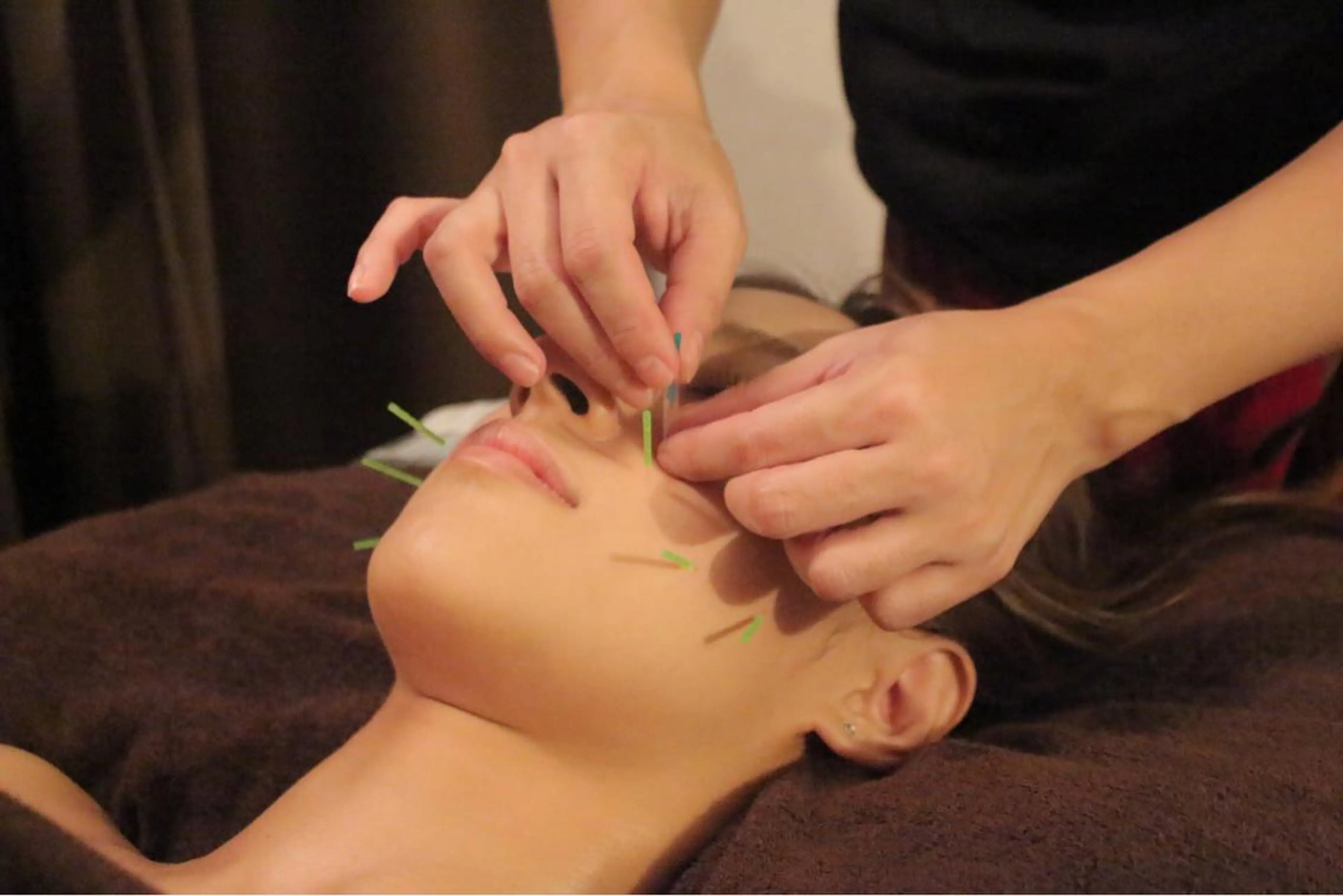 美容鍼灸サロンYOSHINO所属・美容鍼灸サロン YOSHINOのエステ・リラクイメージ