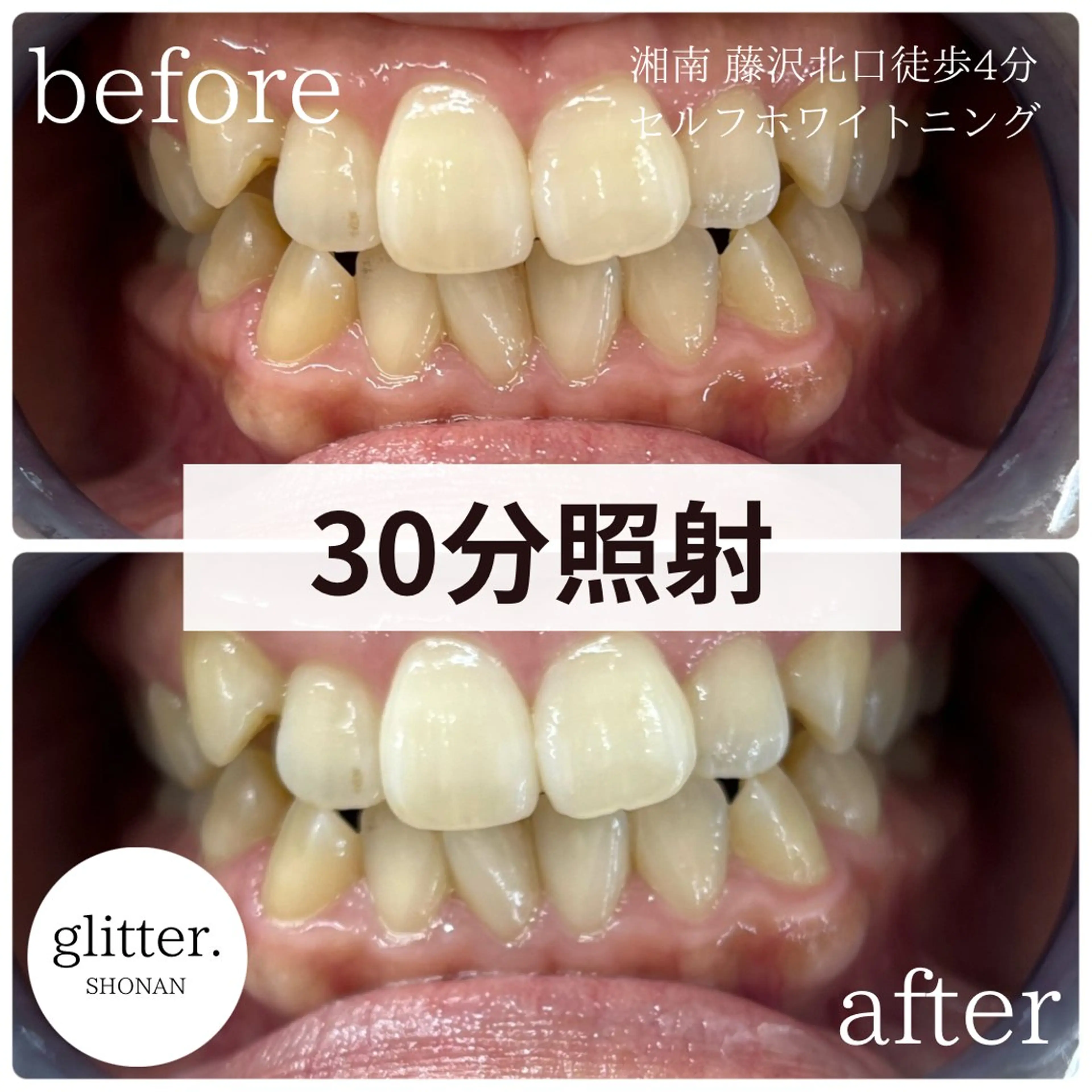 glitter.SHONAN所属・佐久間 茉弥のエステ・リラクイメージ