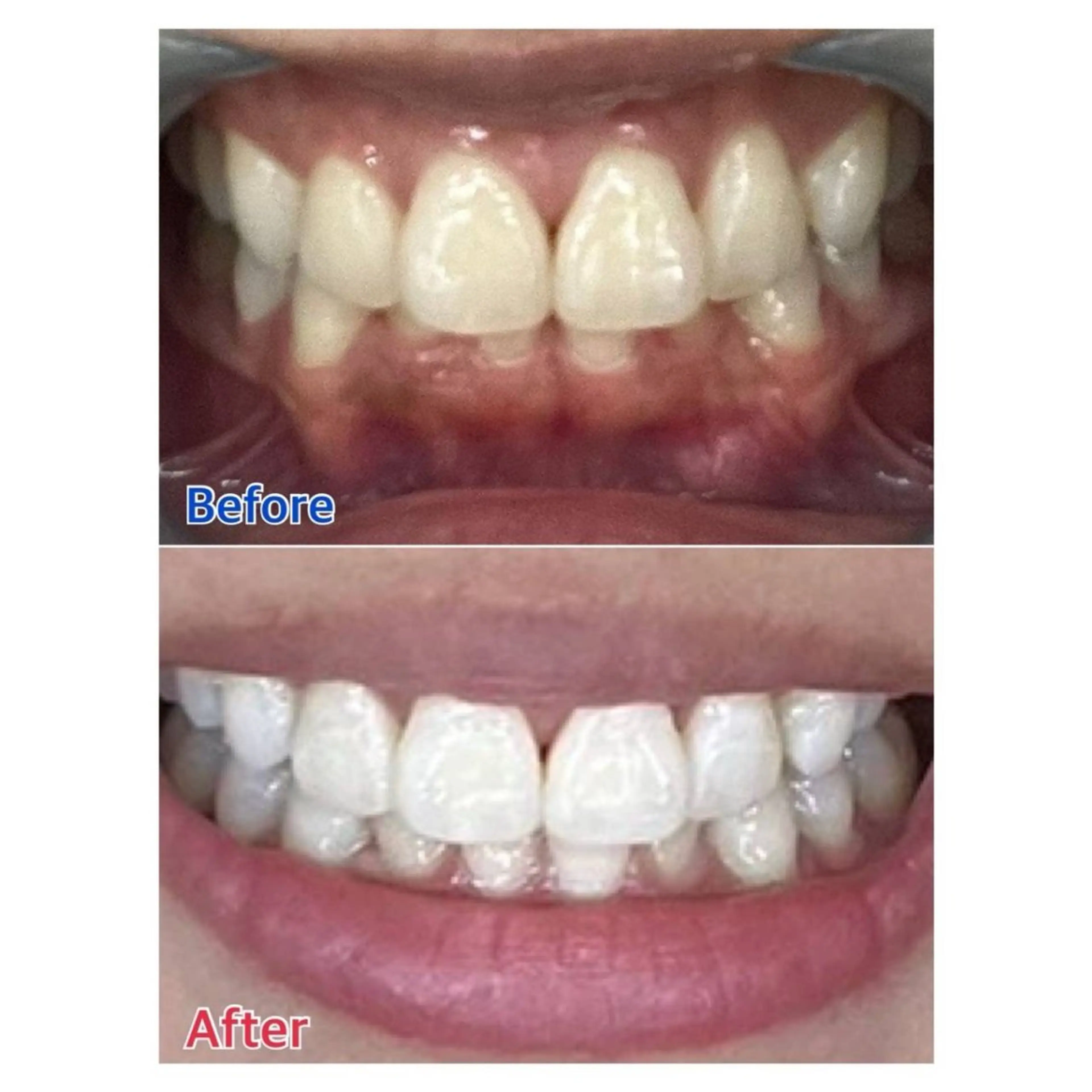 MBEAUTYSALON 千葉店・京成大久保所属・Melty 輝のその他イメージ