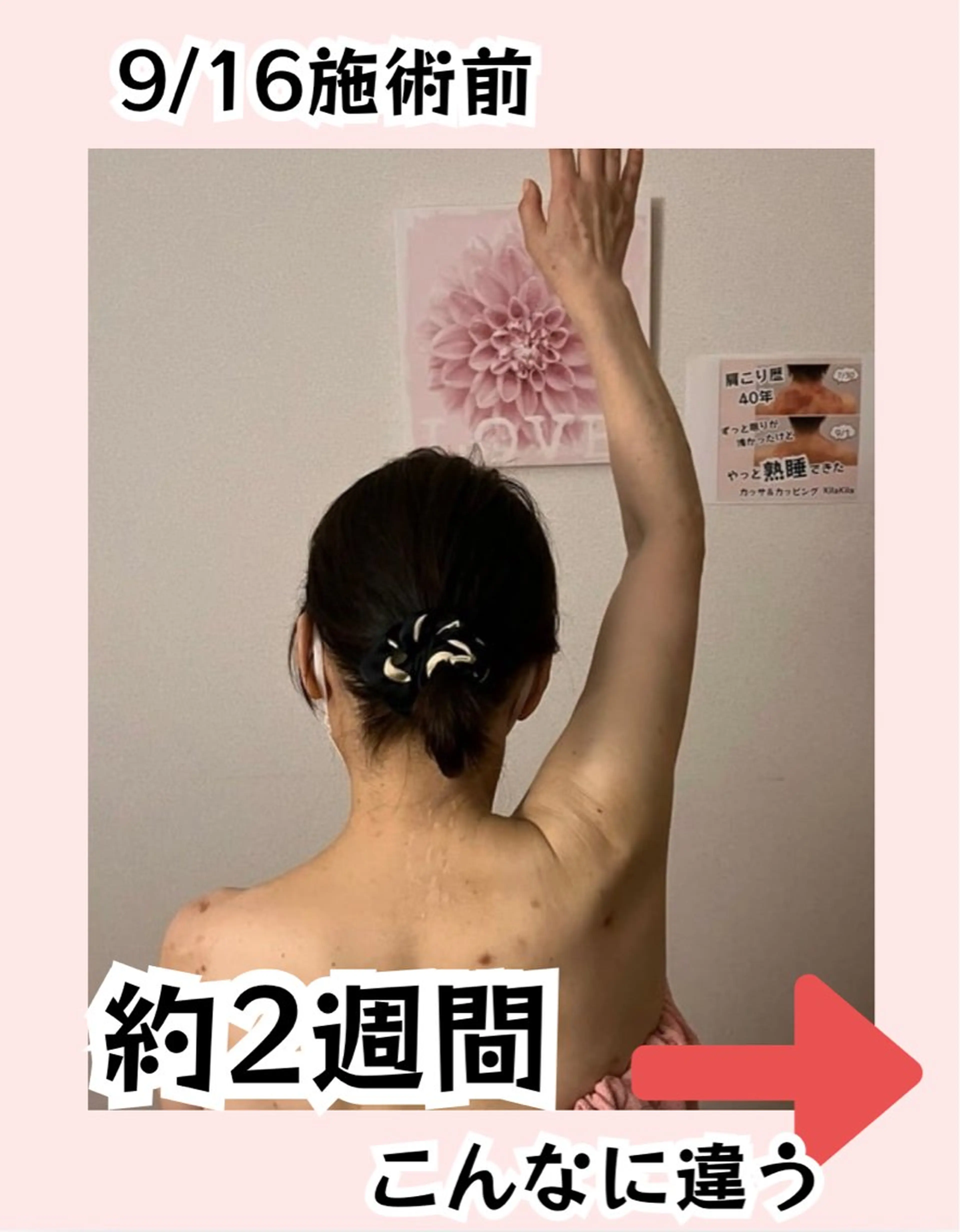 ドライヘッドスパ KilaKilaのエステ・リラクイメージ