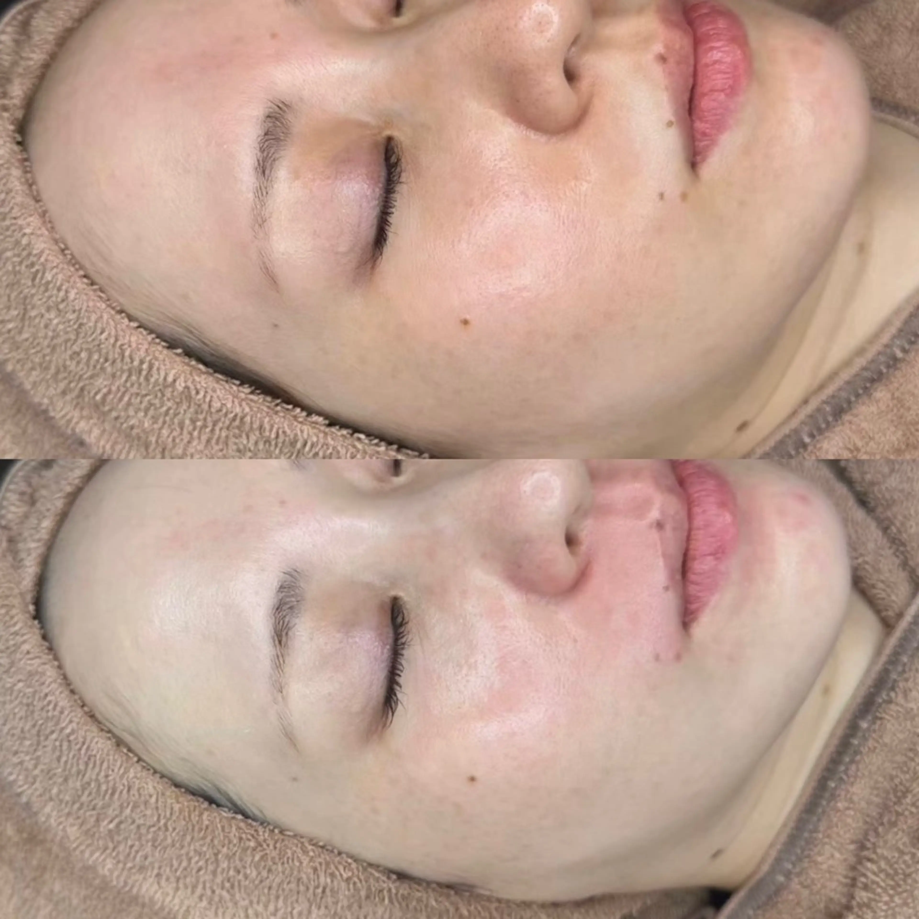 ララピールの写真