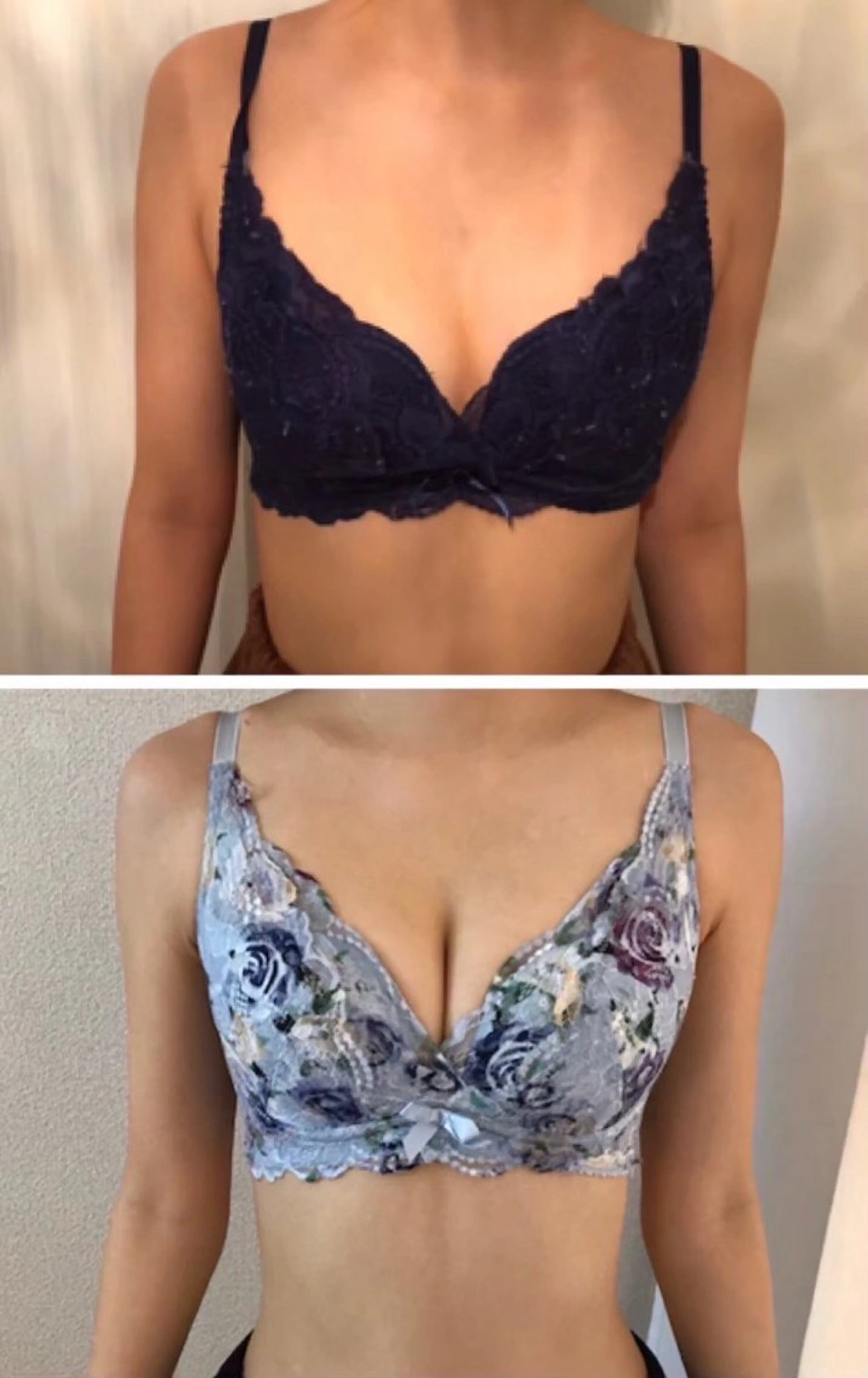 バストアップ60分の施術コースの写真