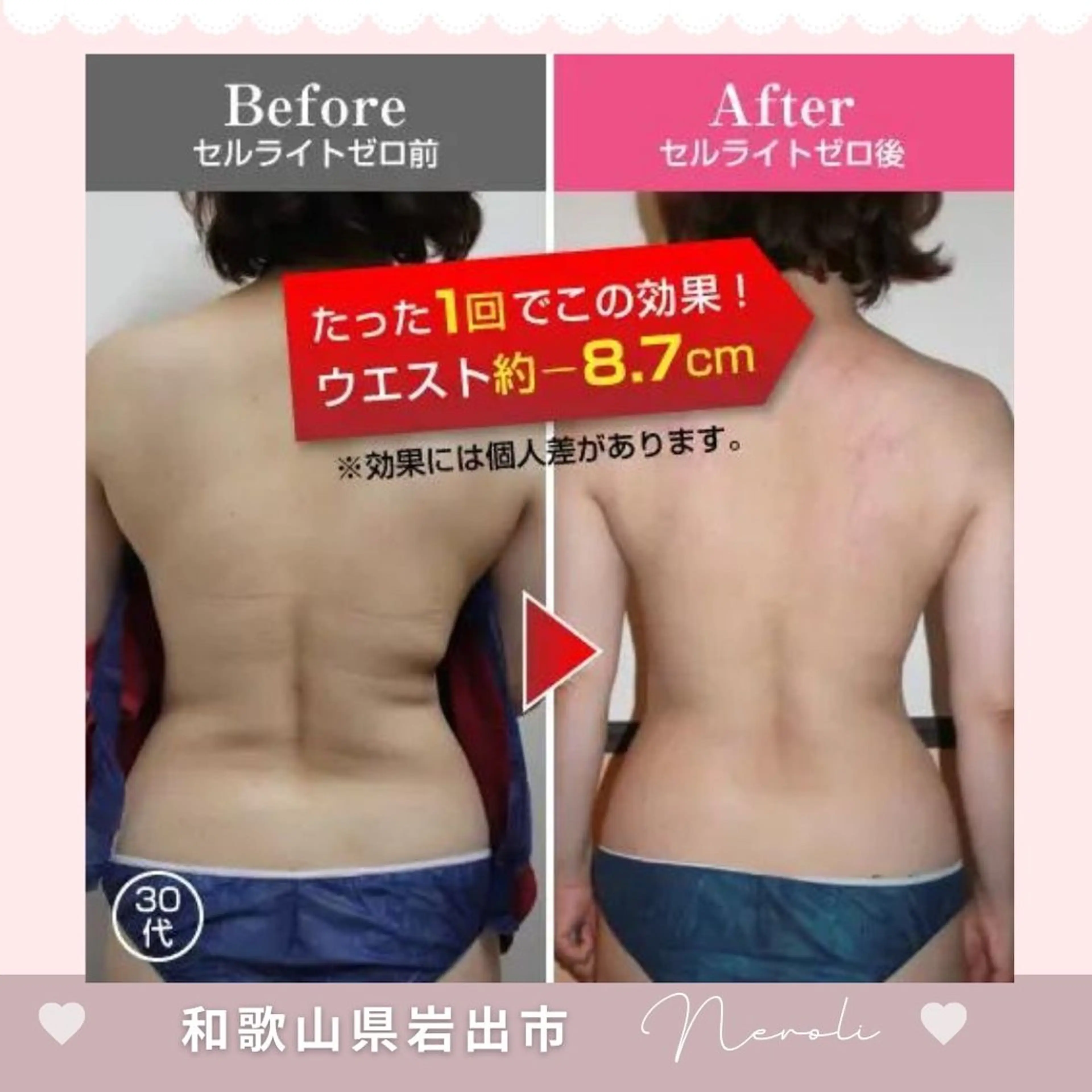 エステ 温活beautyサロンNeroli所属・切らない脂肪吸引🔥 Neroliまりこのエステ・リラクイメージ