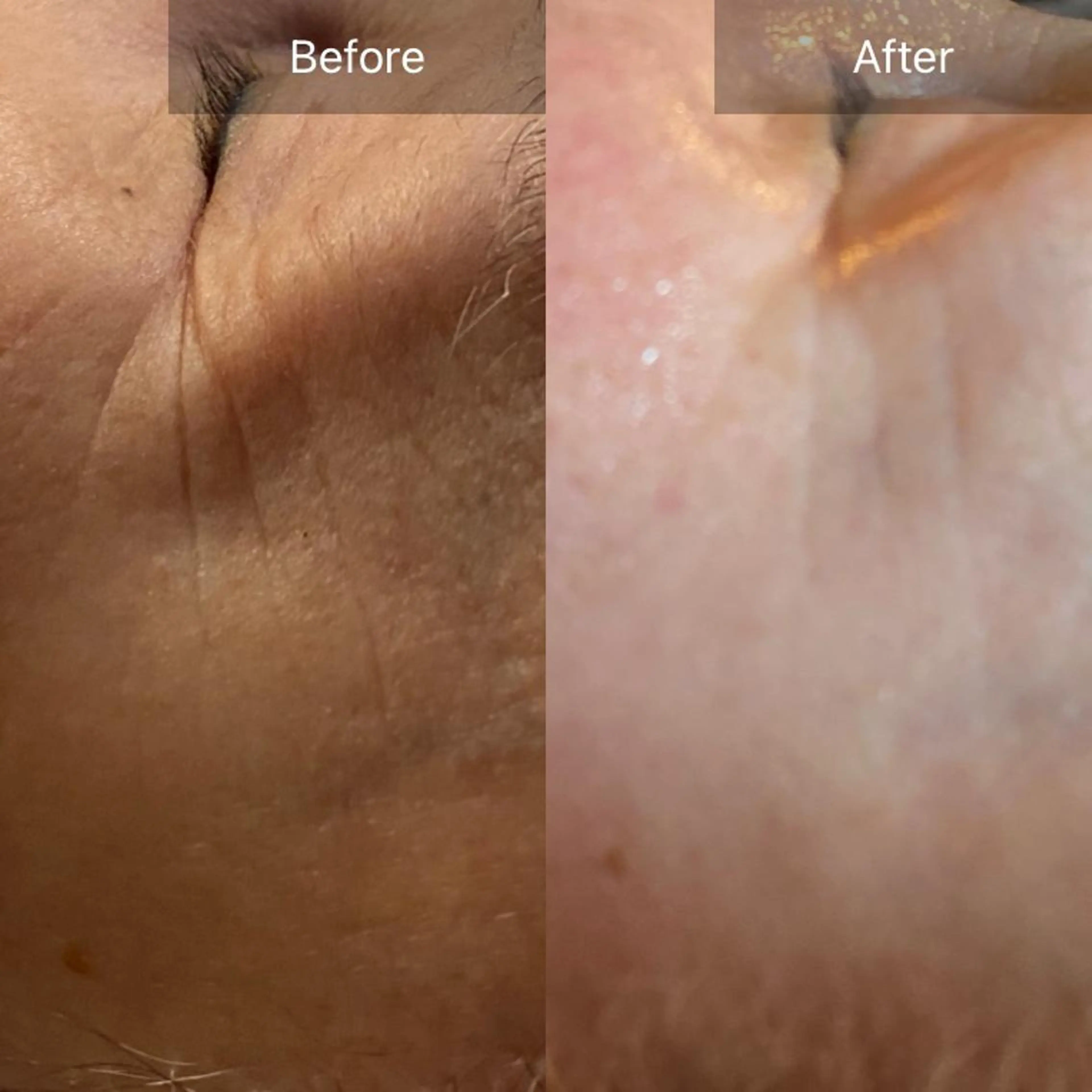 Mandarin Orange所属・毛穴から始める肌メン テマンダリンオレンジのエステ・リラクイメージ