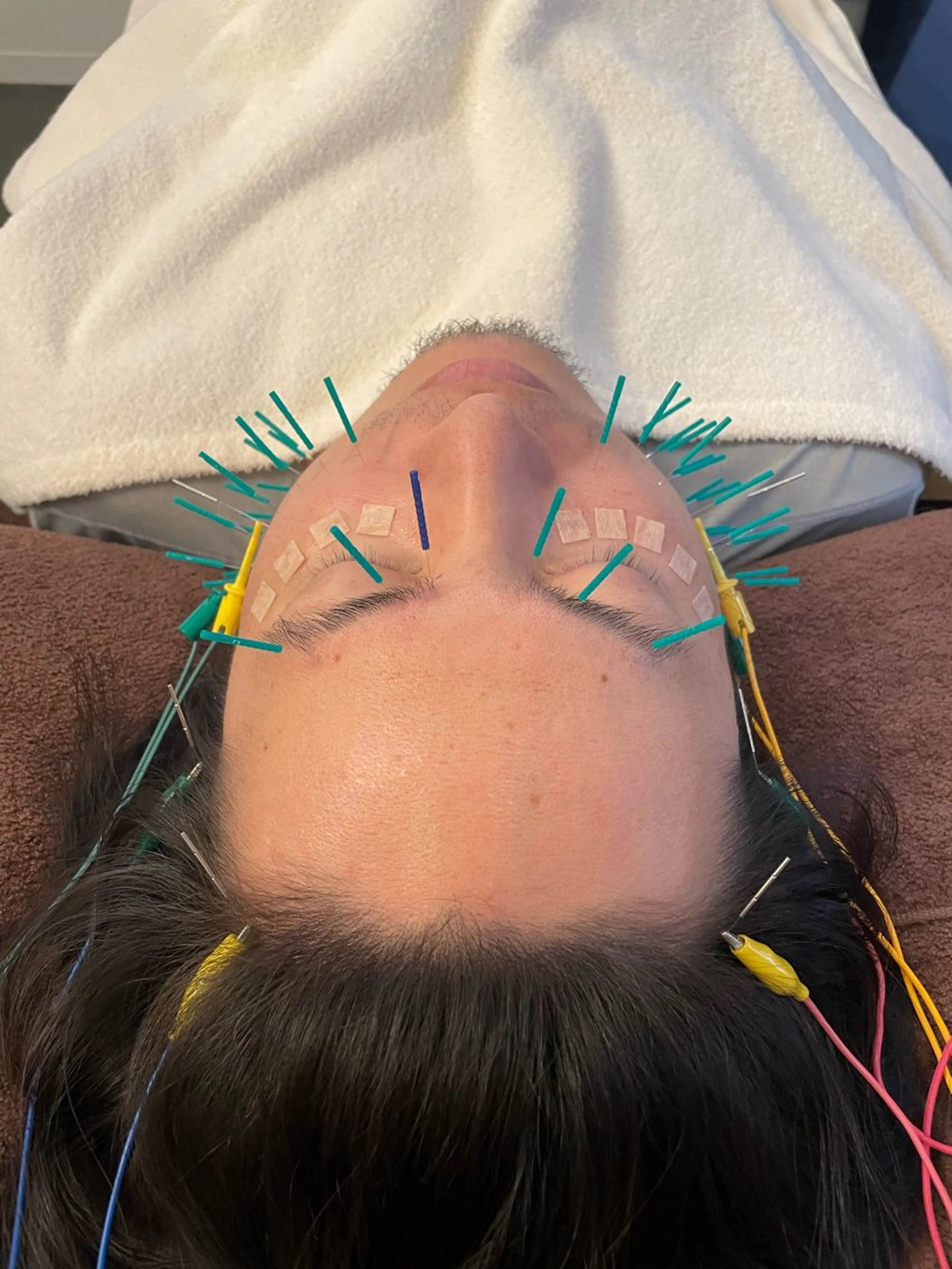 美容鍼　蒼月-aotsuki-所属・美容鍼「蒼月」 -アオツキ-のエステ・リラクイメージ