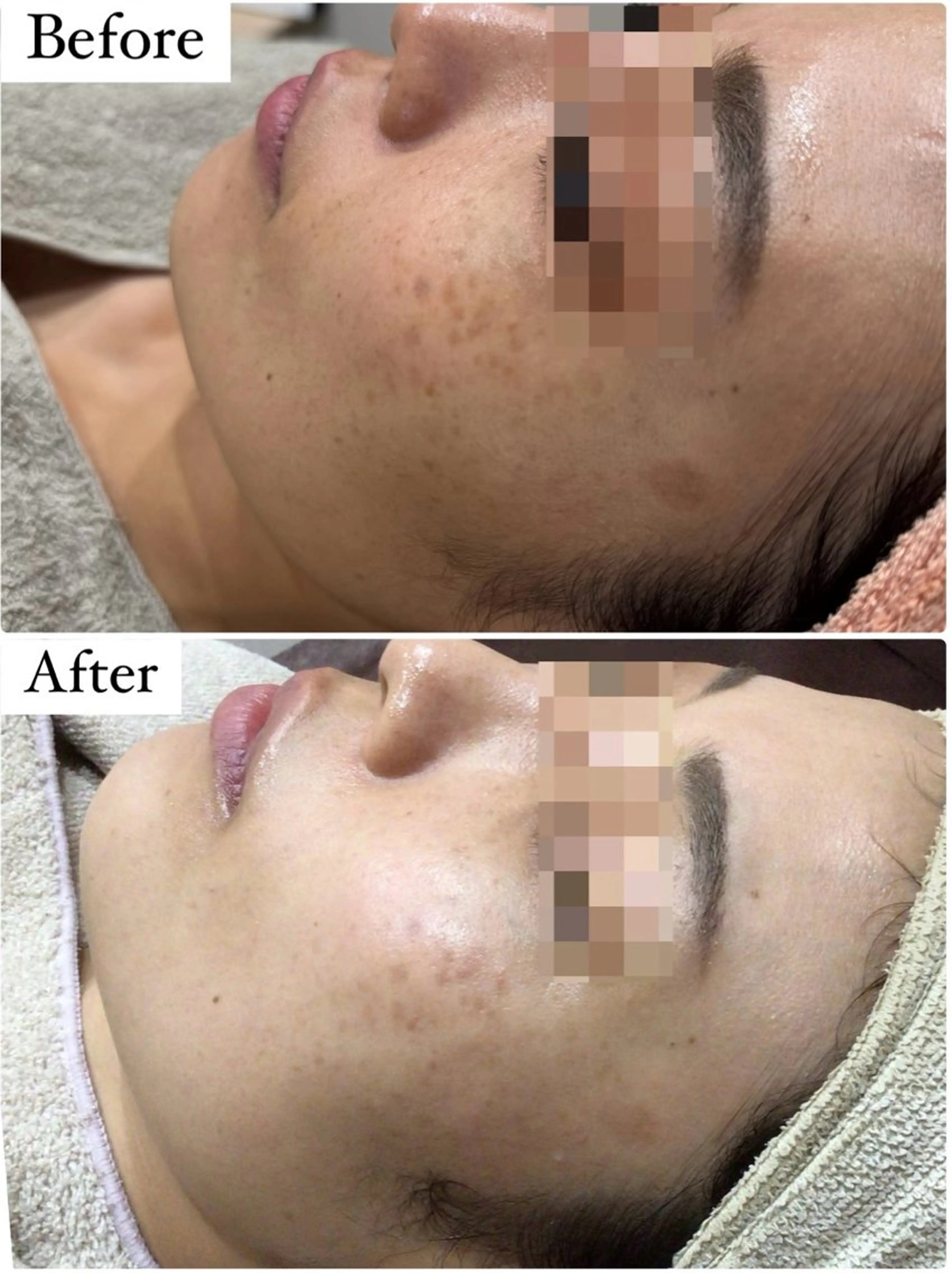 ハーブピーリング専門 muro.のエステ・リラクイメージ