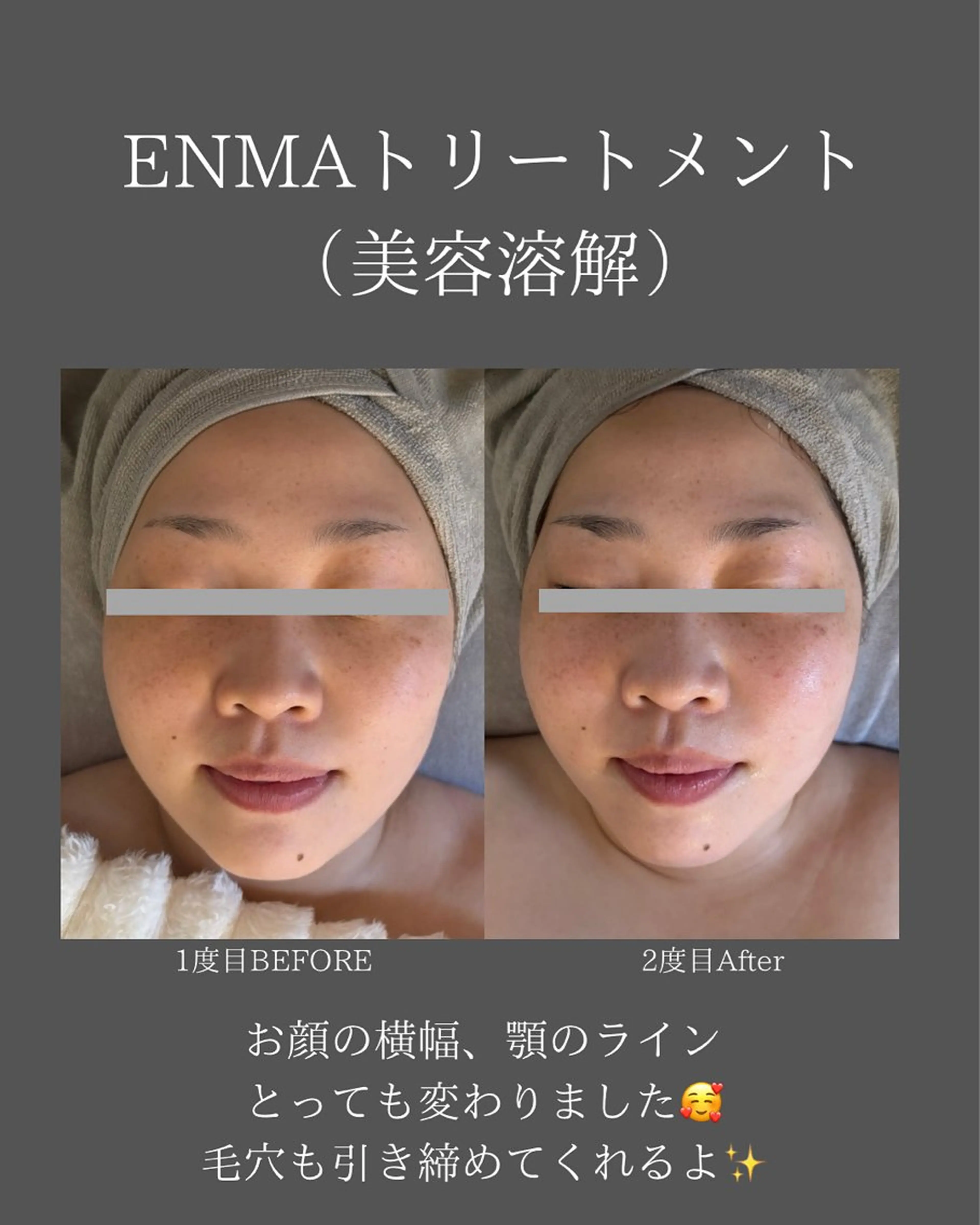 BLOSSOM 菊地のエステ・リラクイメージ