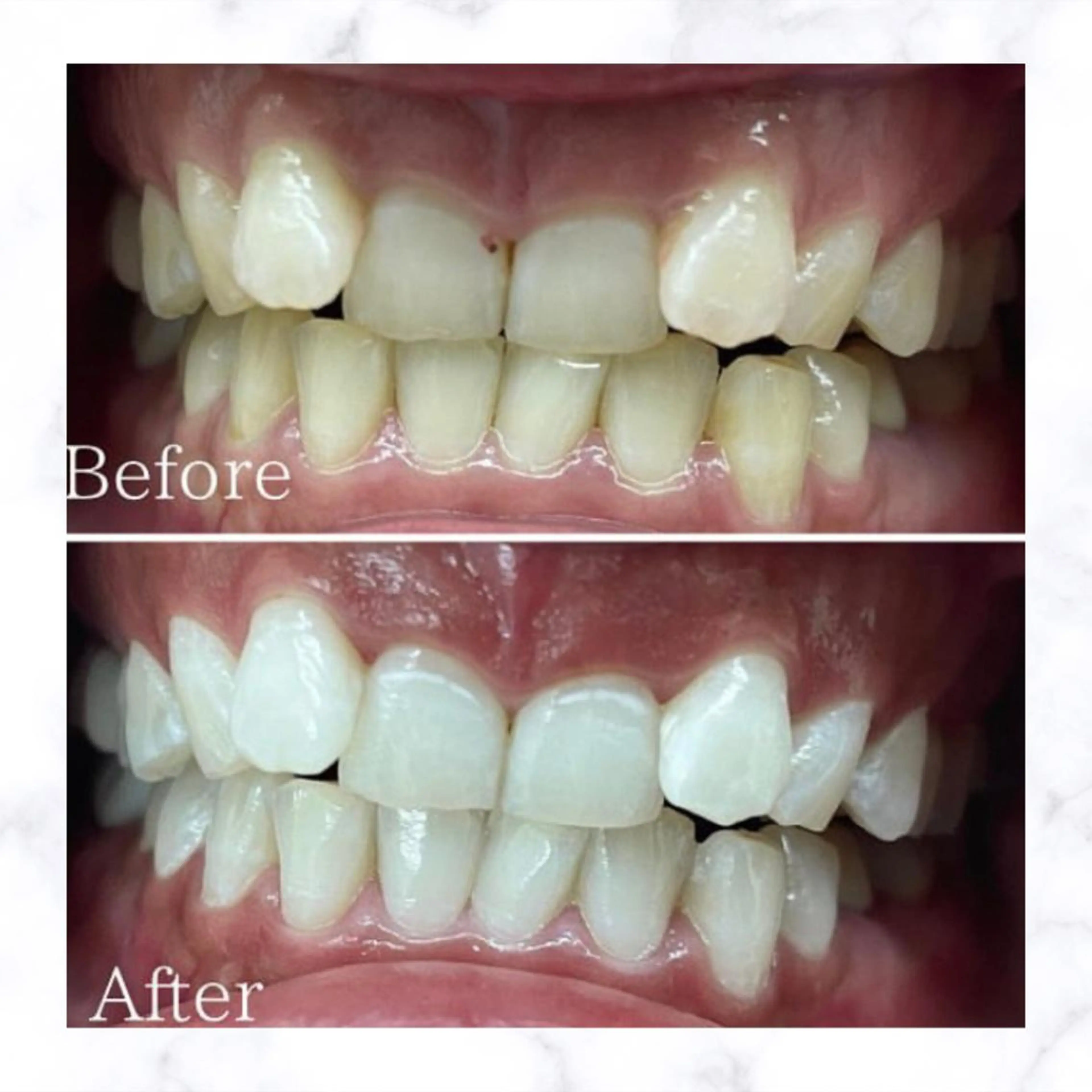 メンズ 学生（メンズ向け） ホワイトニング専門店 WHITE天神店のエステ・リラクイメージ