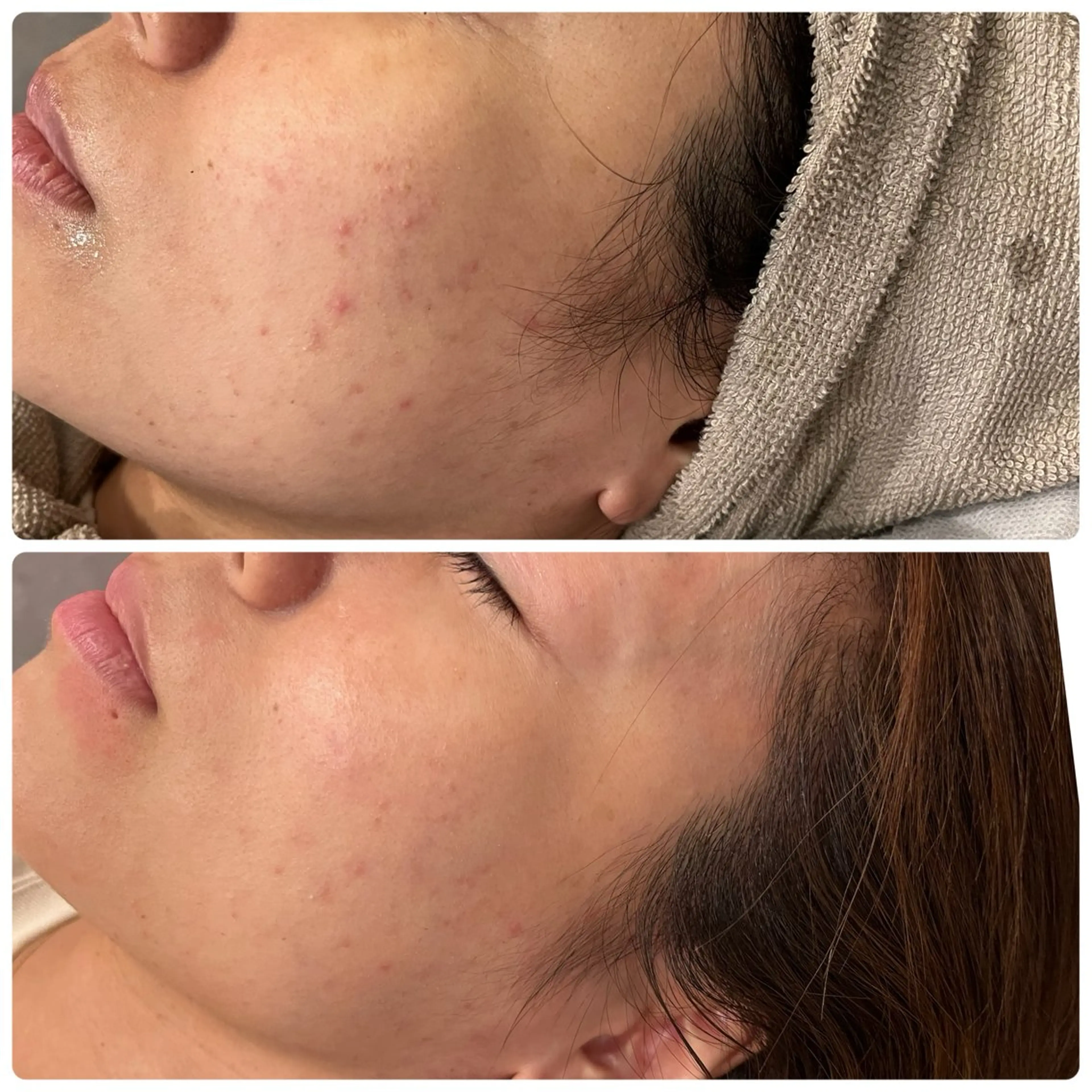 脱毛 yellow.所属・yellow💛【 脱毛&フェイシャル】のエステ・リラクイメージ