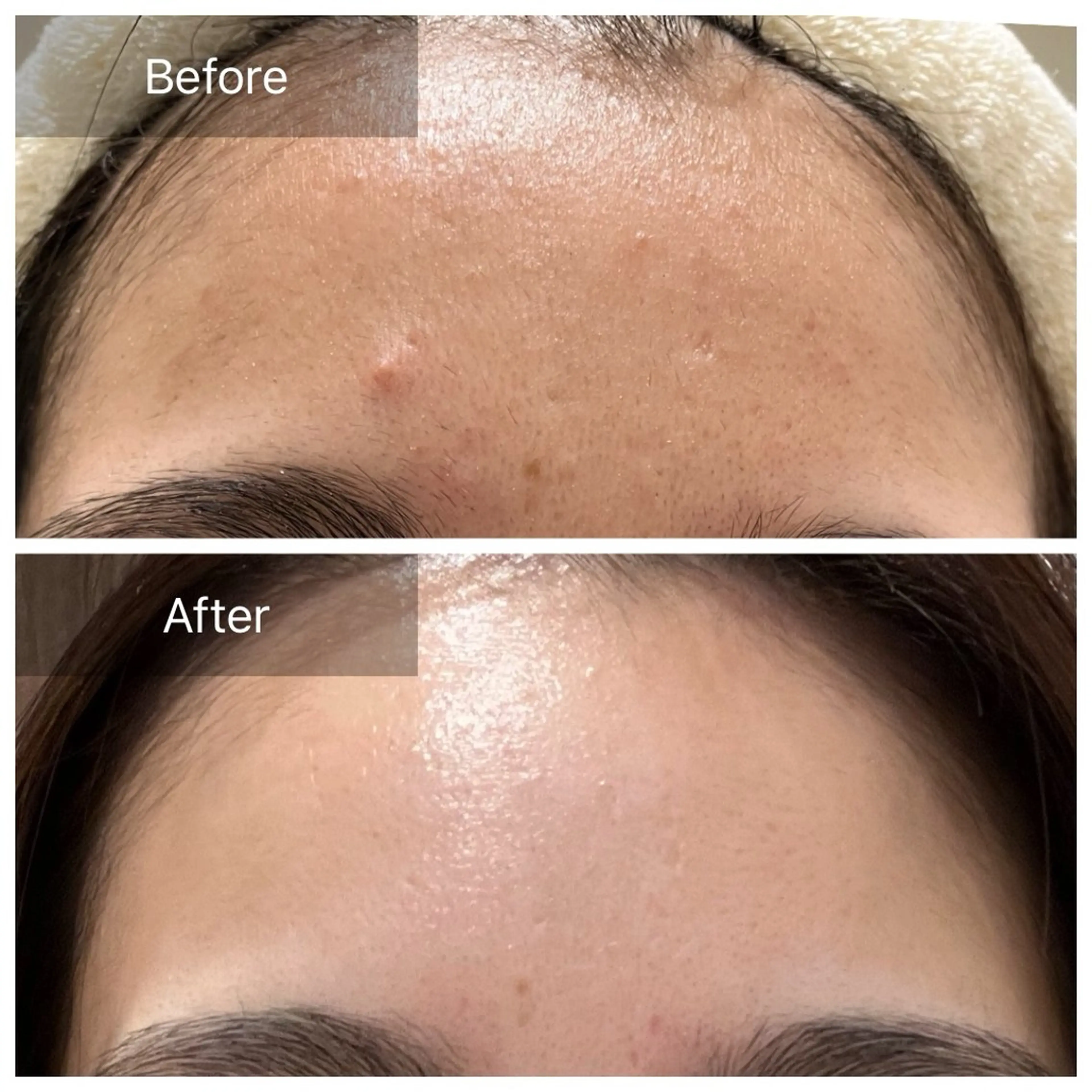 毛穴が見えなくなるサロン  Horo所属・岡 えり子のエステ・リラクイメージ