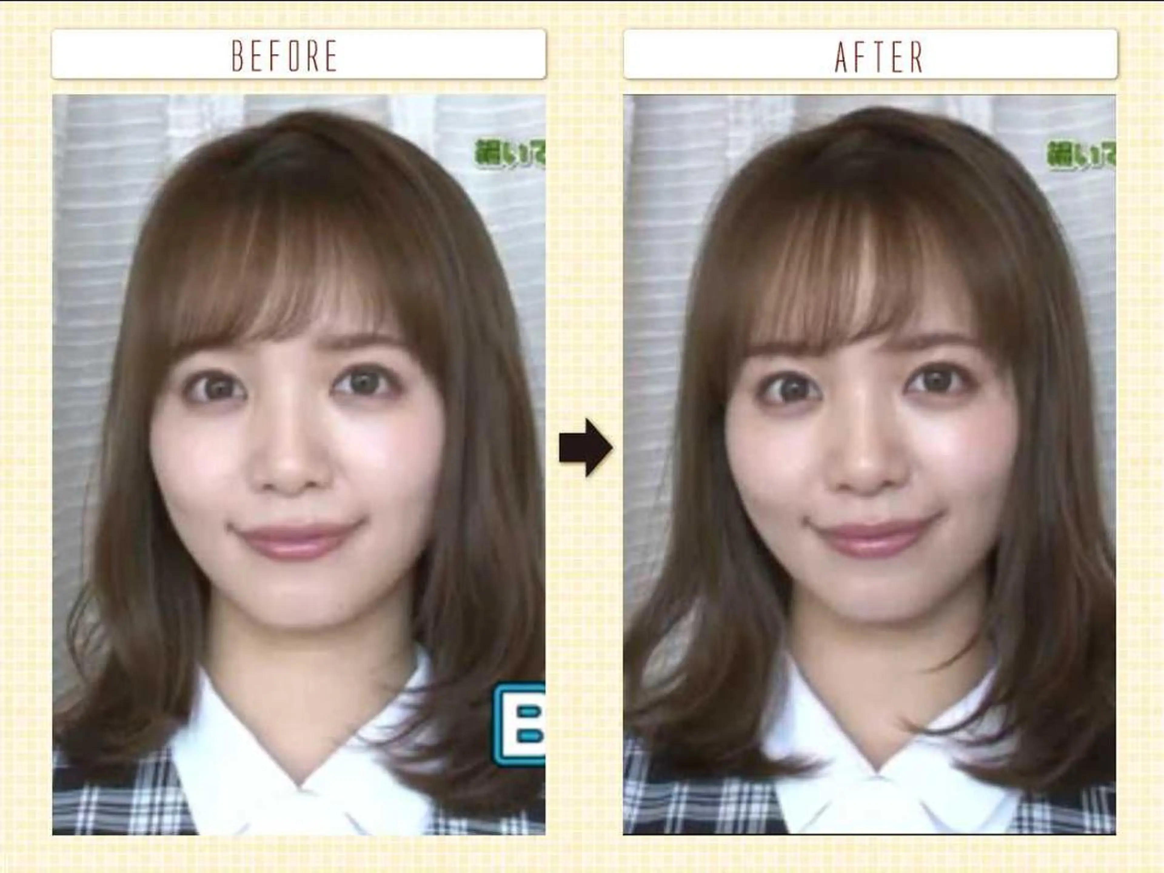 むくみたるみ専門☆ 美容鍼・小顔矯正のエステ・リラクイメージ