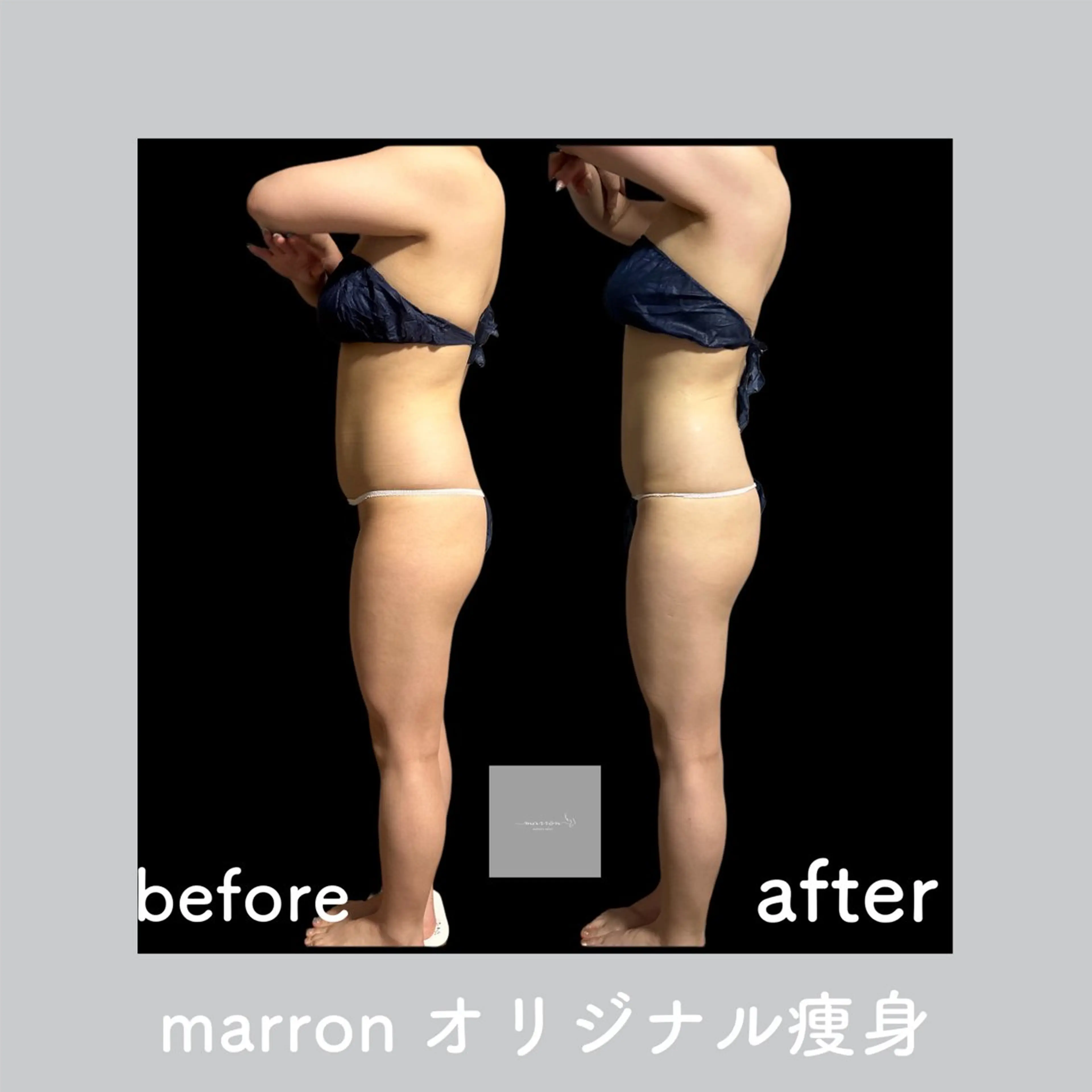 marron所属・痩身ハイパーナイフ ララピールリアボーテのエステ・リラクイメージ